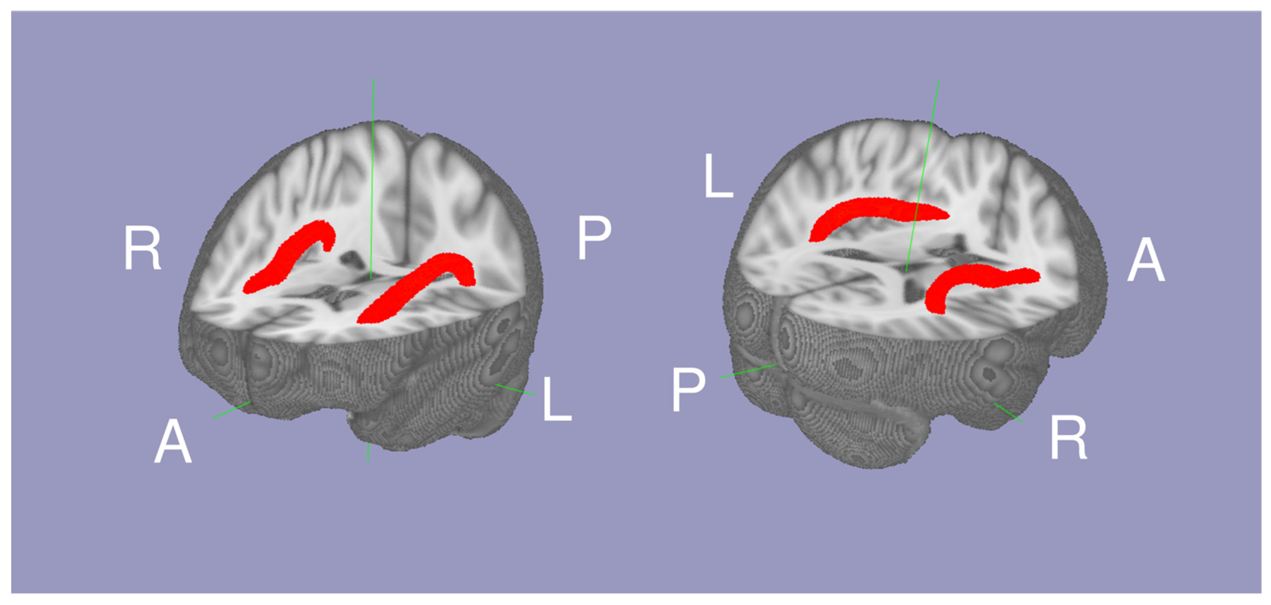 Brainsci 13 00129 g001 Brainsci 13 00129 g001