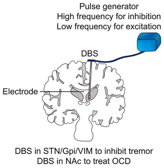Modulating Brain Activity with Invasive Brain–Computer 