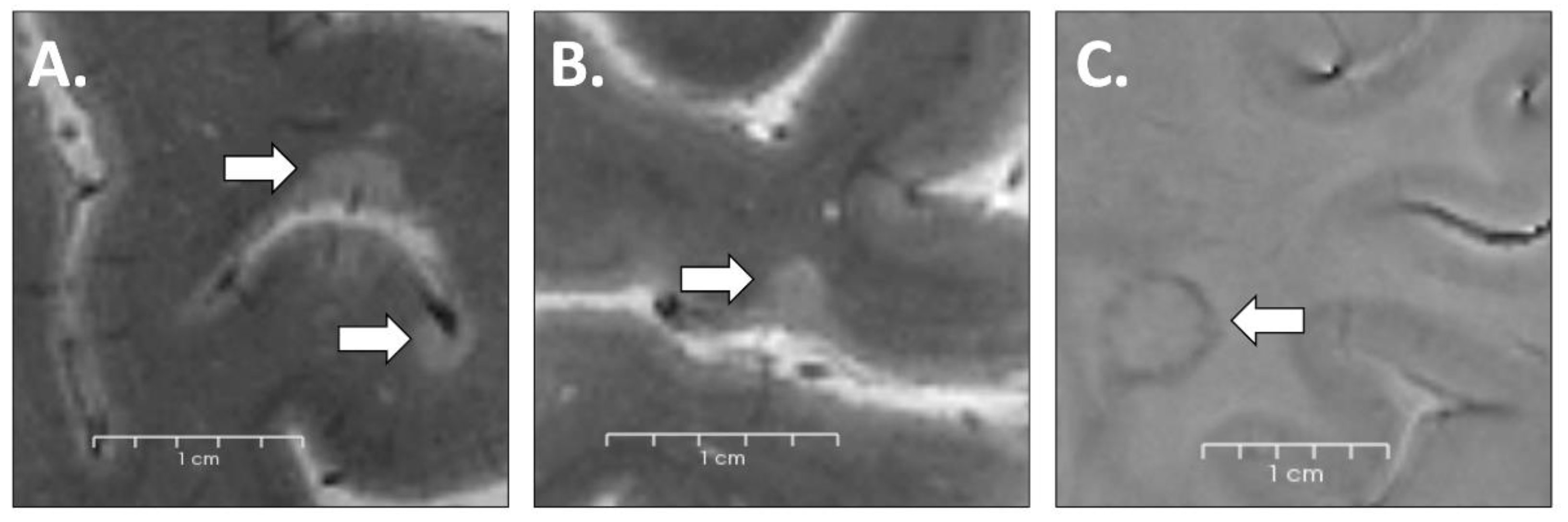 Brainsci 13 00198 g002 Brainsci 13 00198 g002