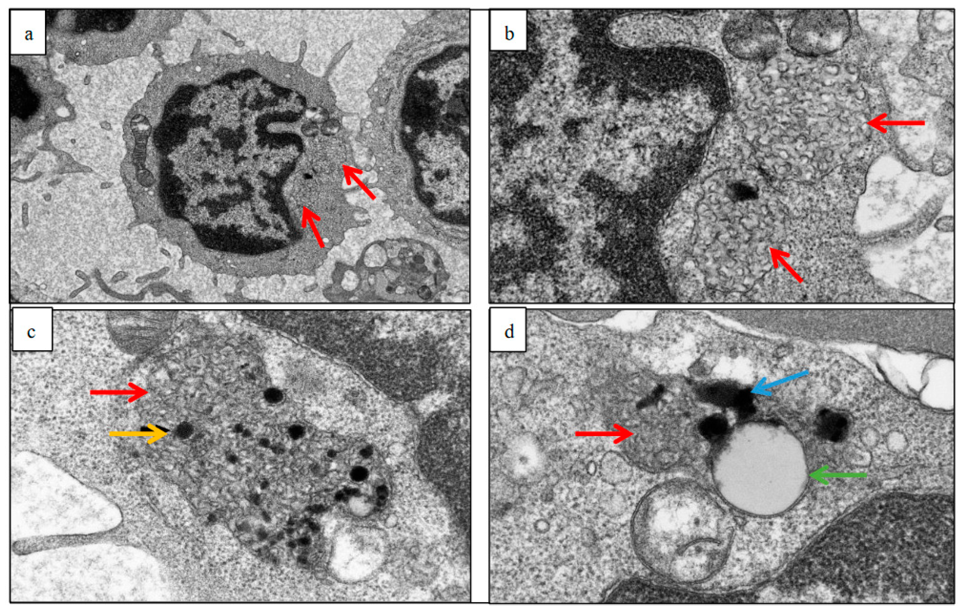 Brainsci 13 00209 g001 Brainsci 13 00209 g001