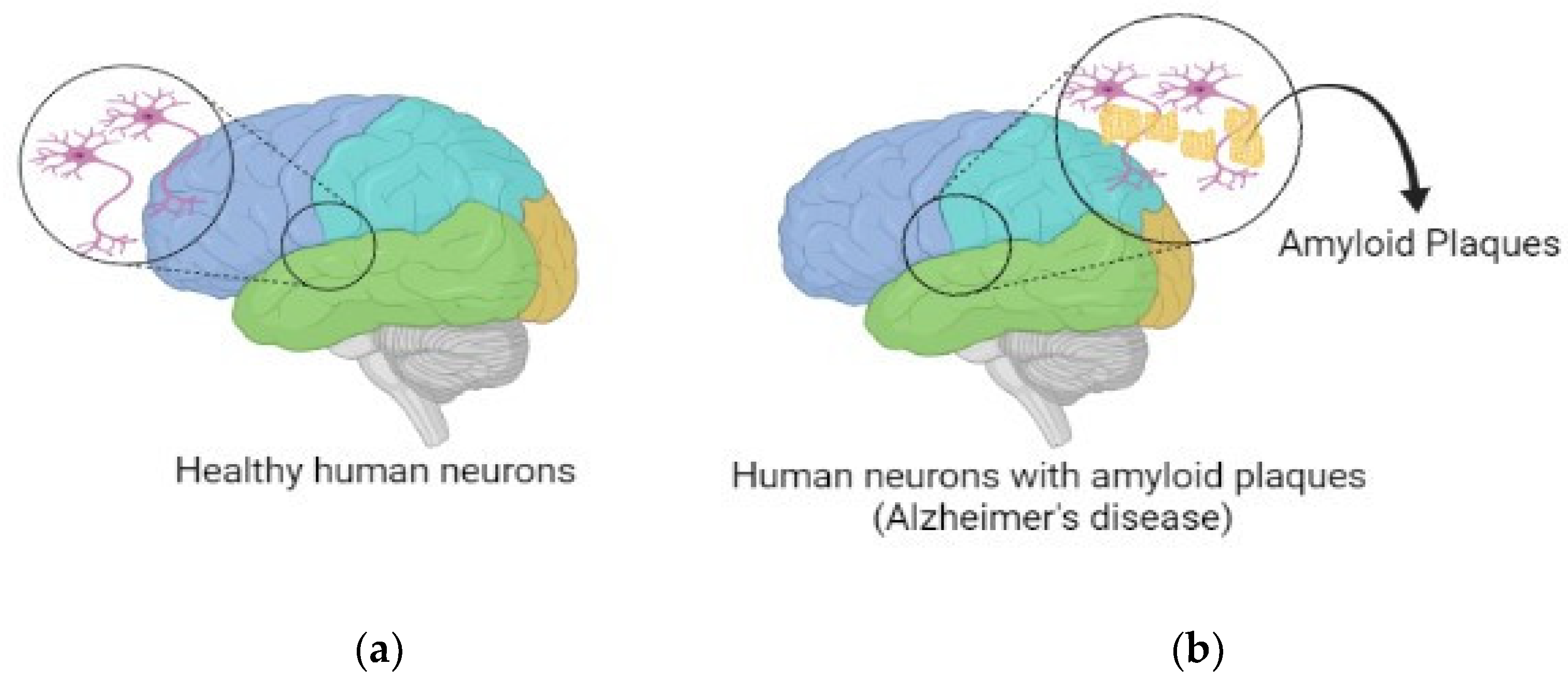 Brainsci 13 00213 g001 Brainsci 13 00213 g001