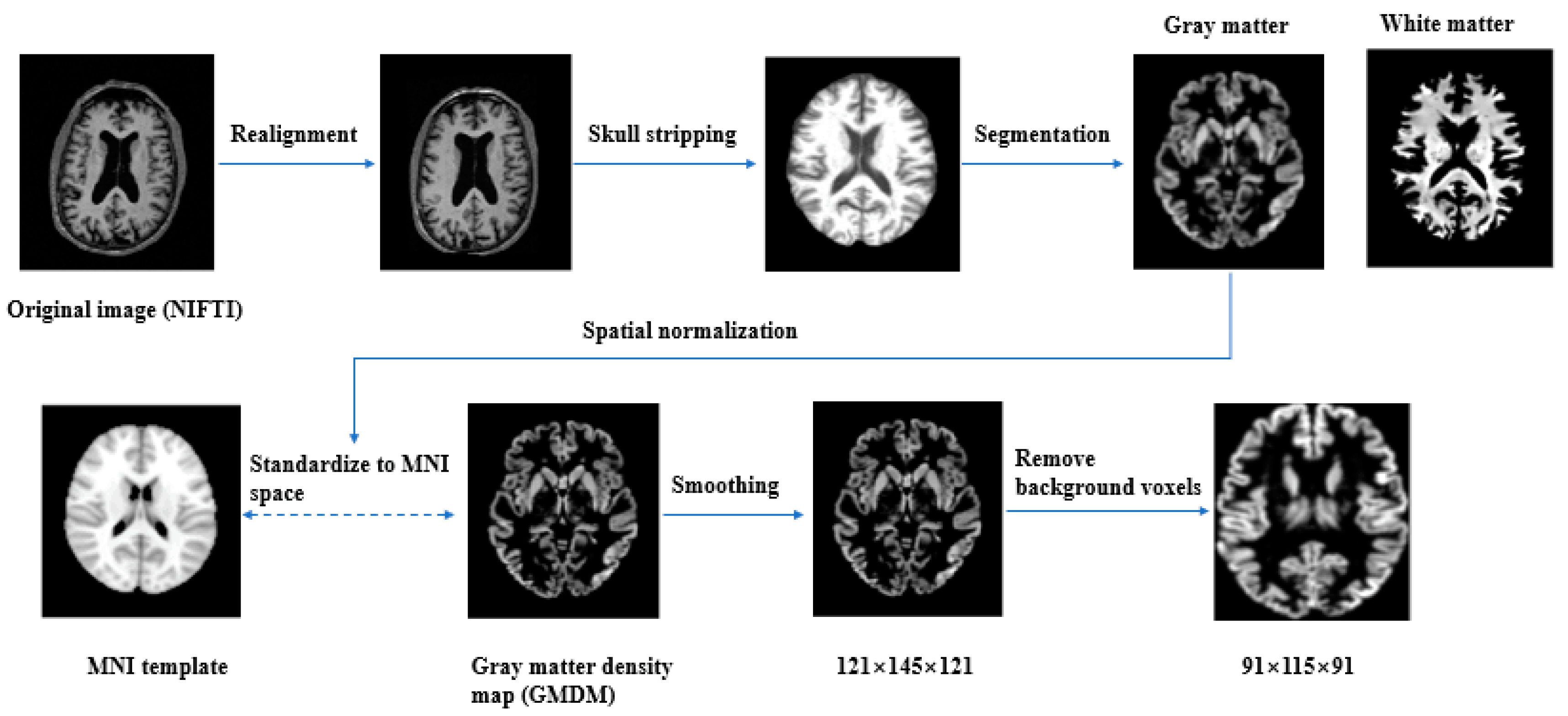 Brainsci 13 00254 g001