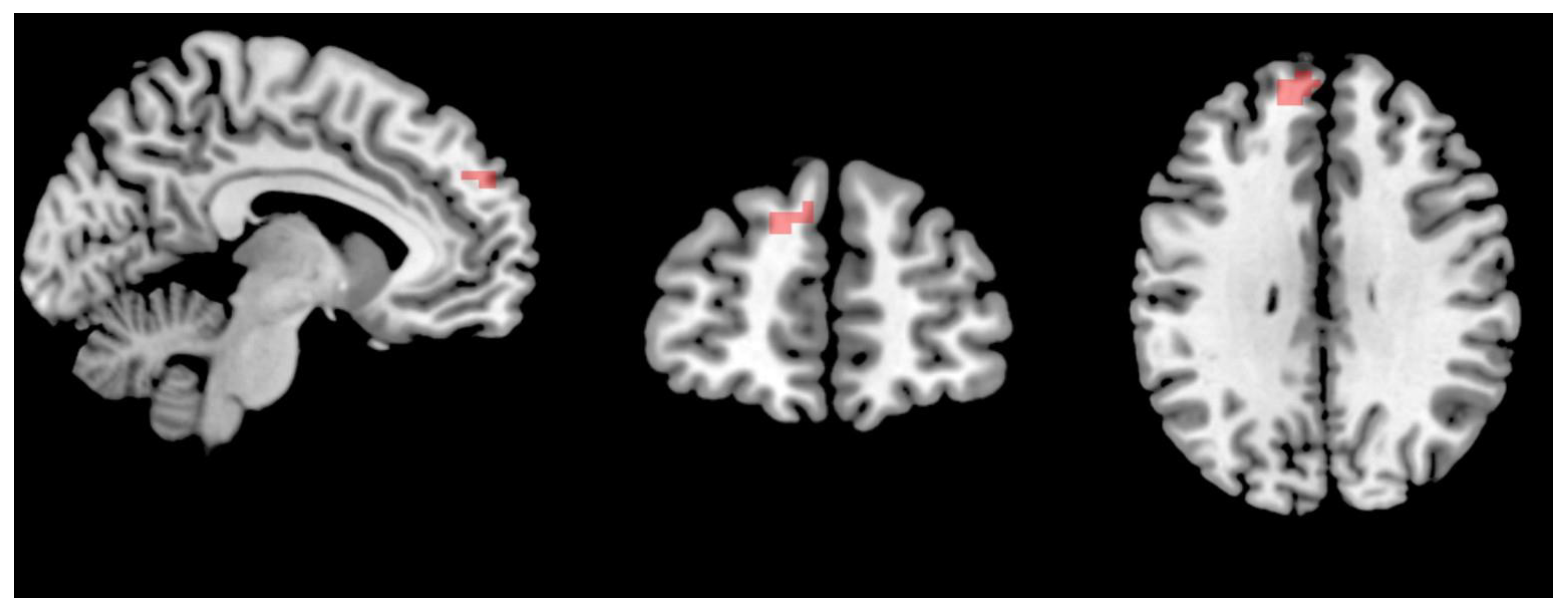 Brainsci 13 00274 g003 550