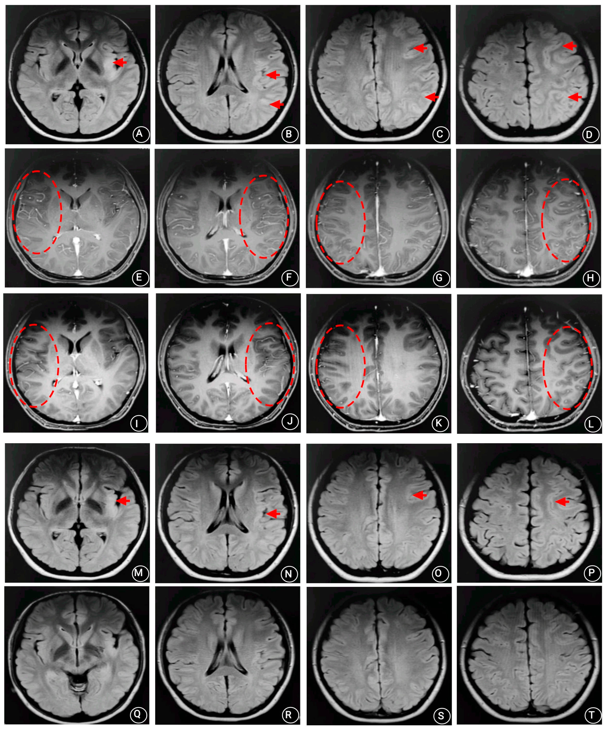 Brainsci 13 00283 g002 550