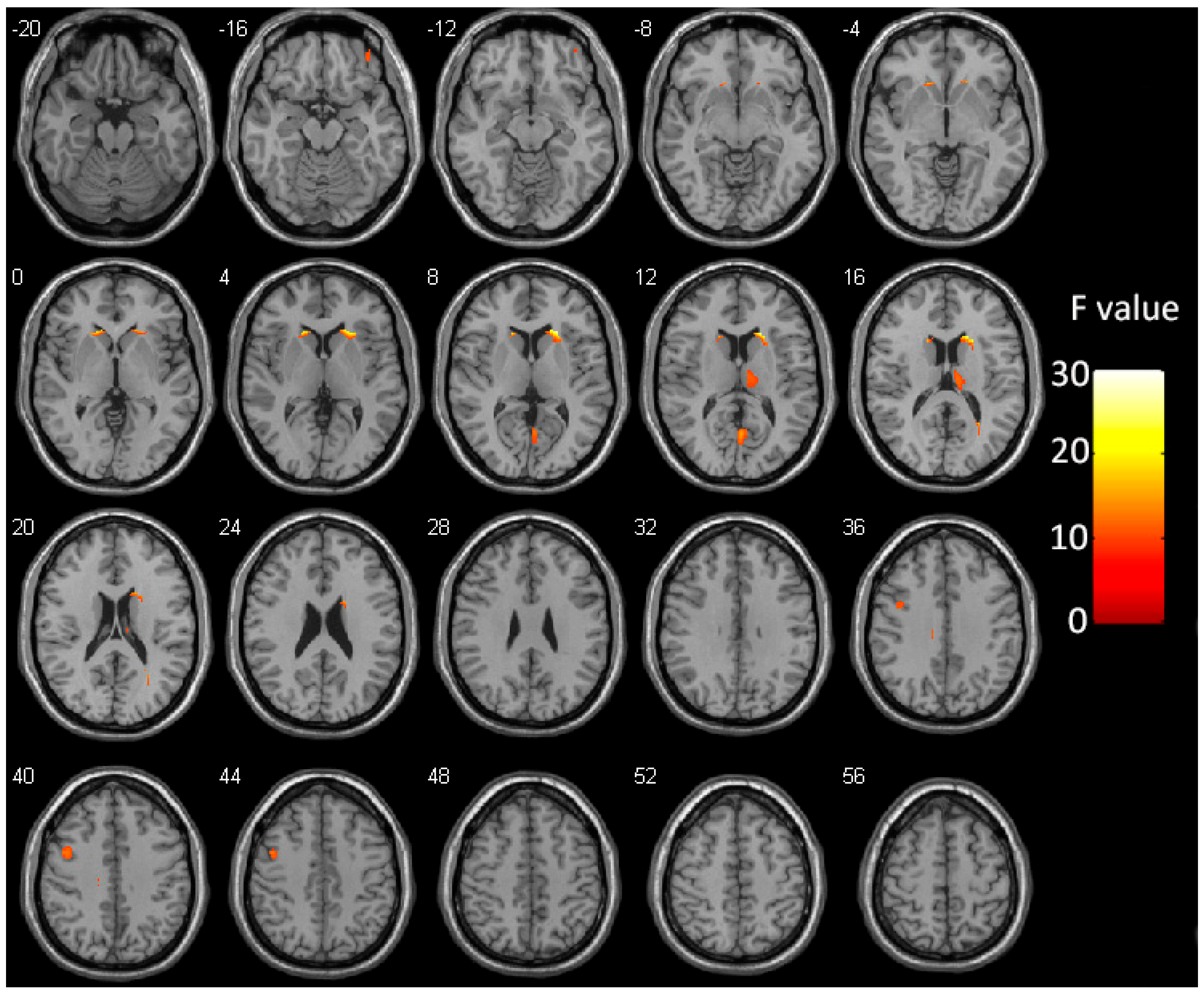 Brainsci 13 00294 g002