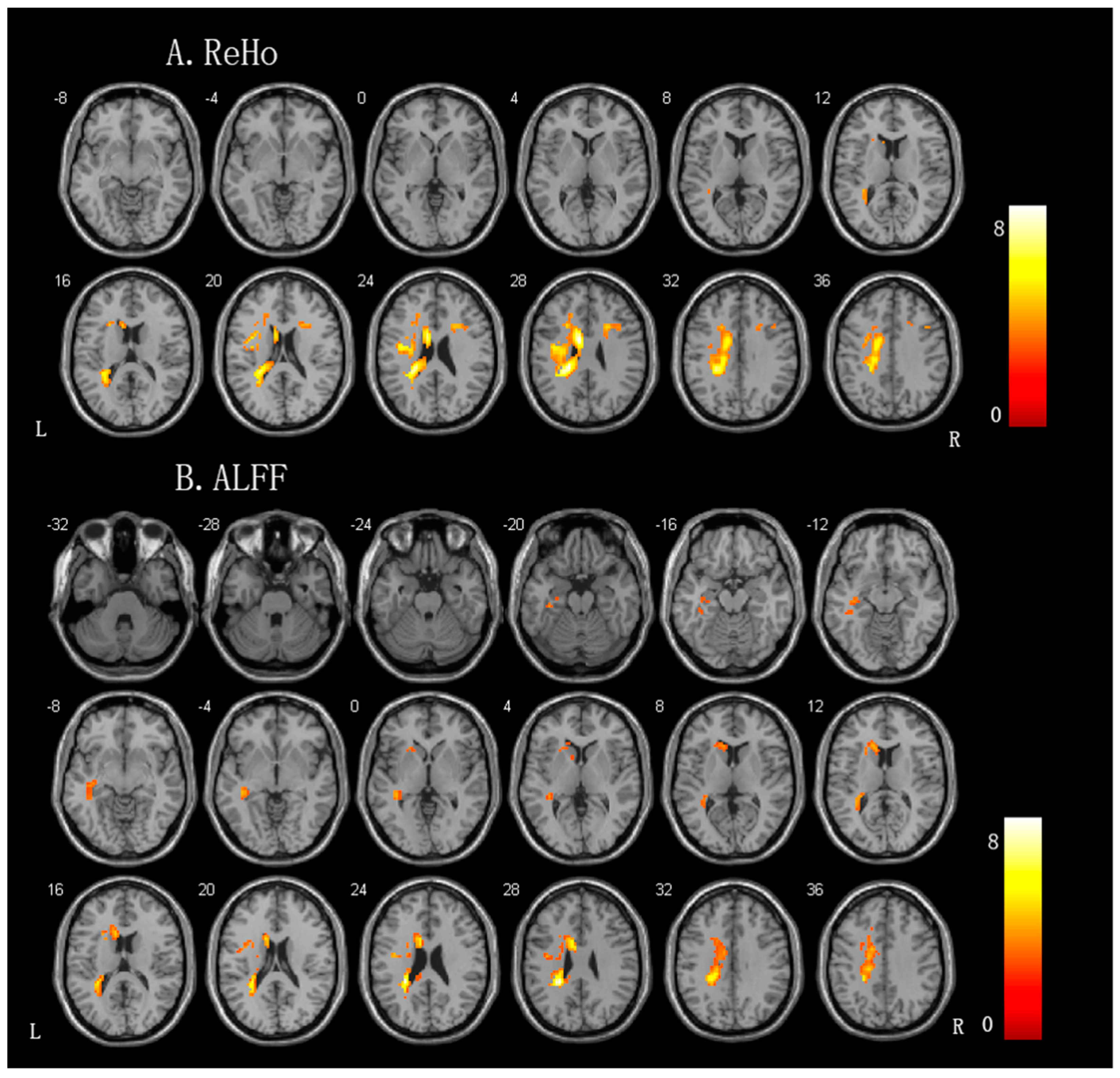 Brainsci 13 00300 g002