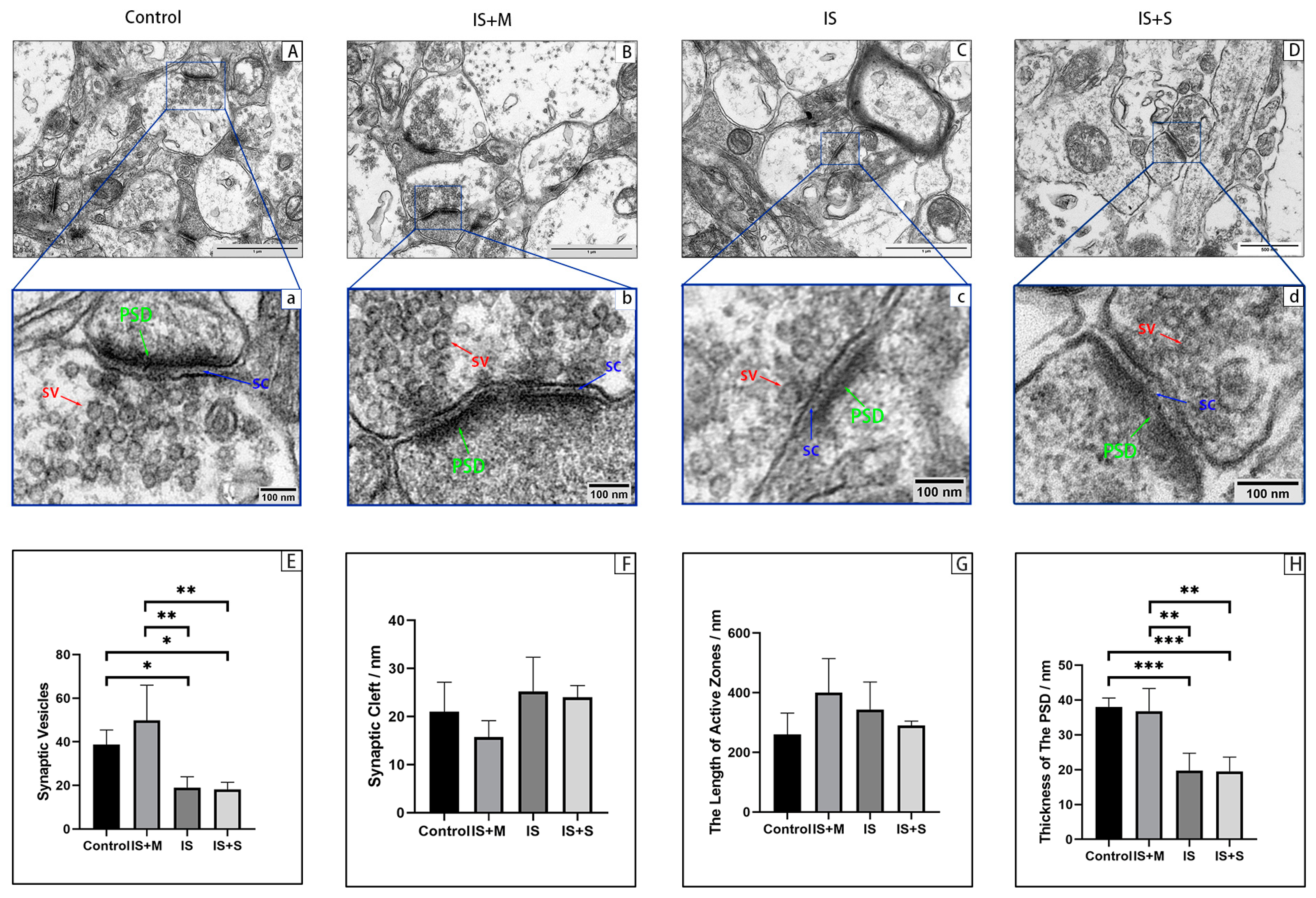 Brainsci 13 00331 g012
