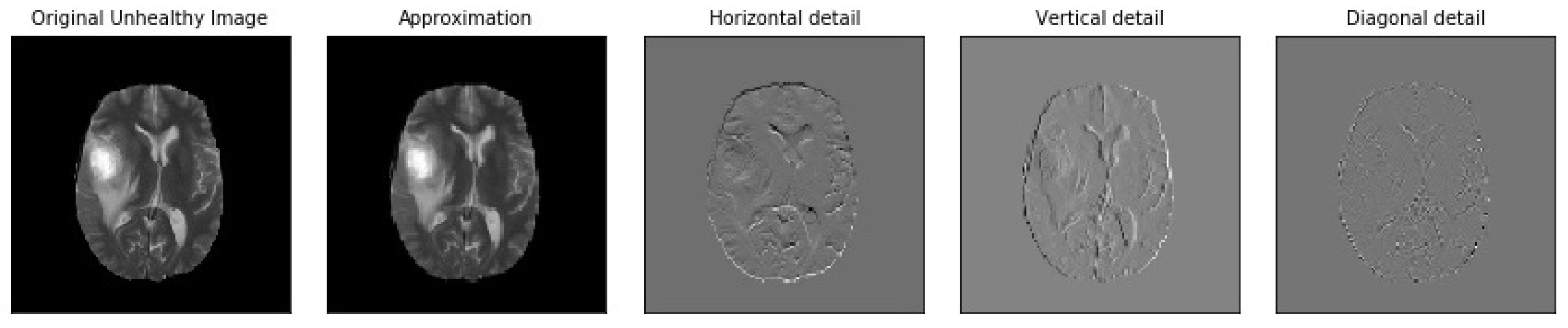 Brainsci 13 00348 g005 Brainsci 13 00348 g005