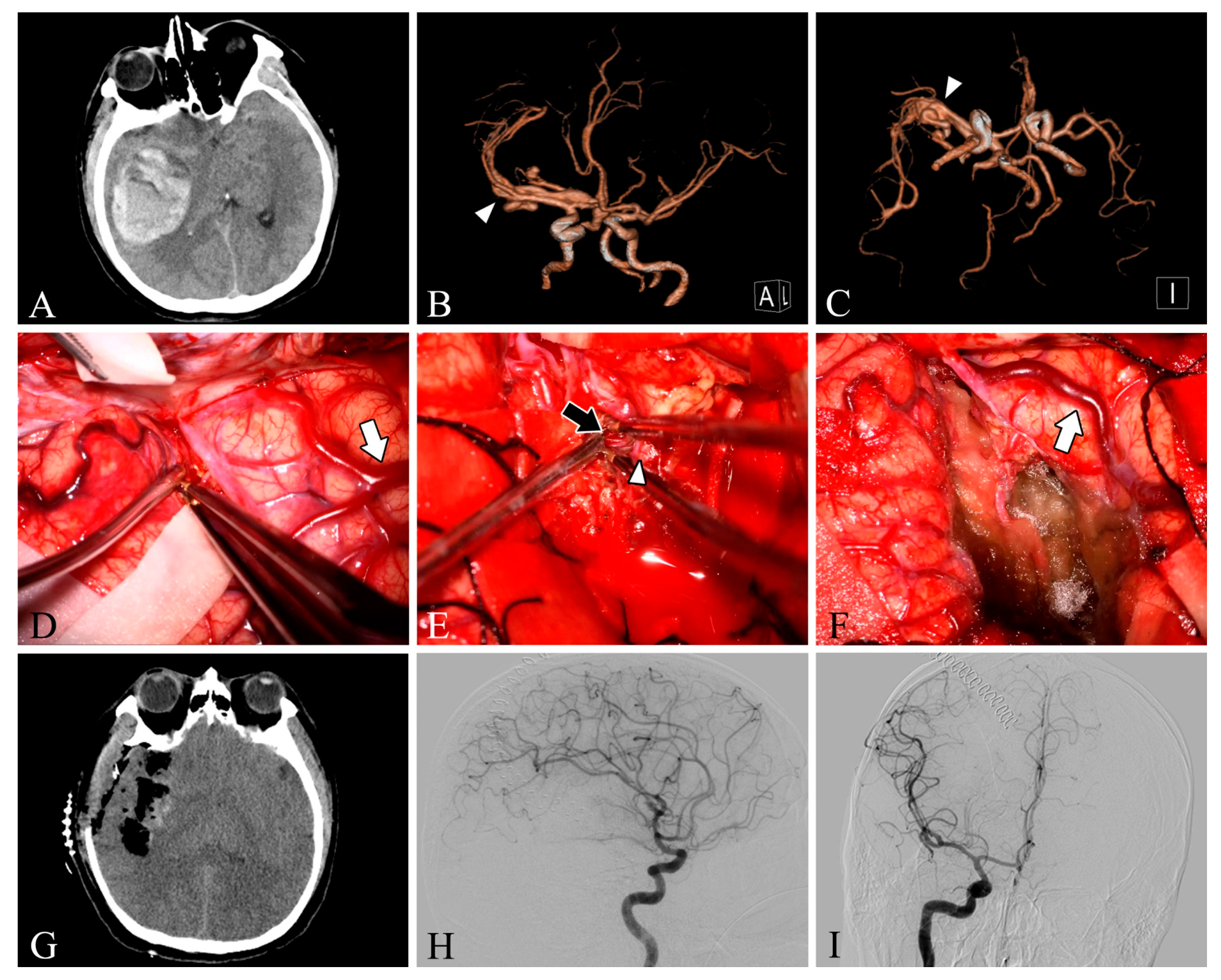 Brainsci 13 00366 g001