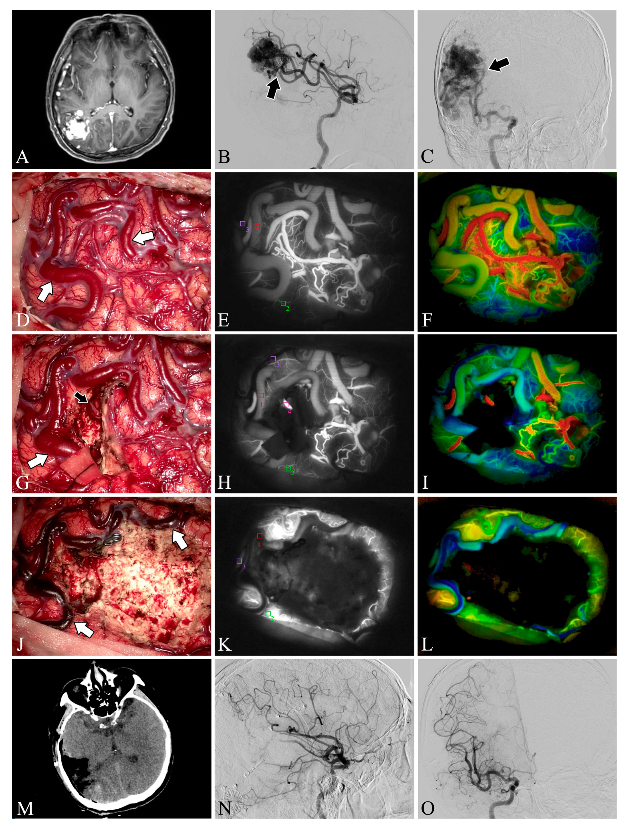 Brainsci 13 00366 g003