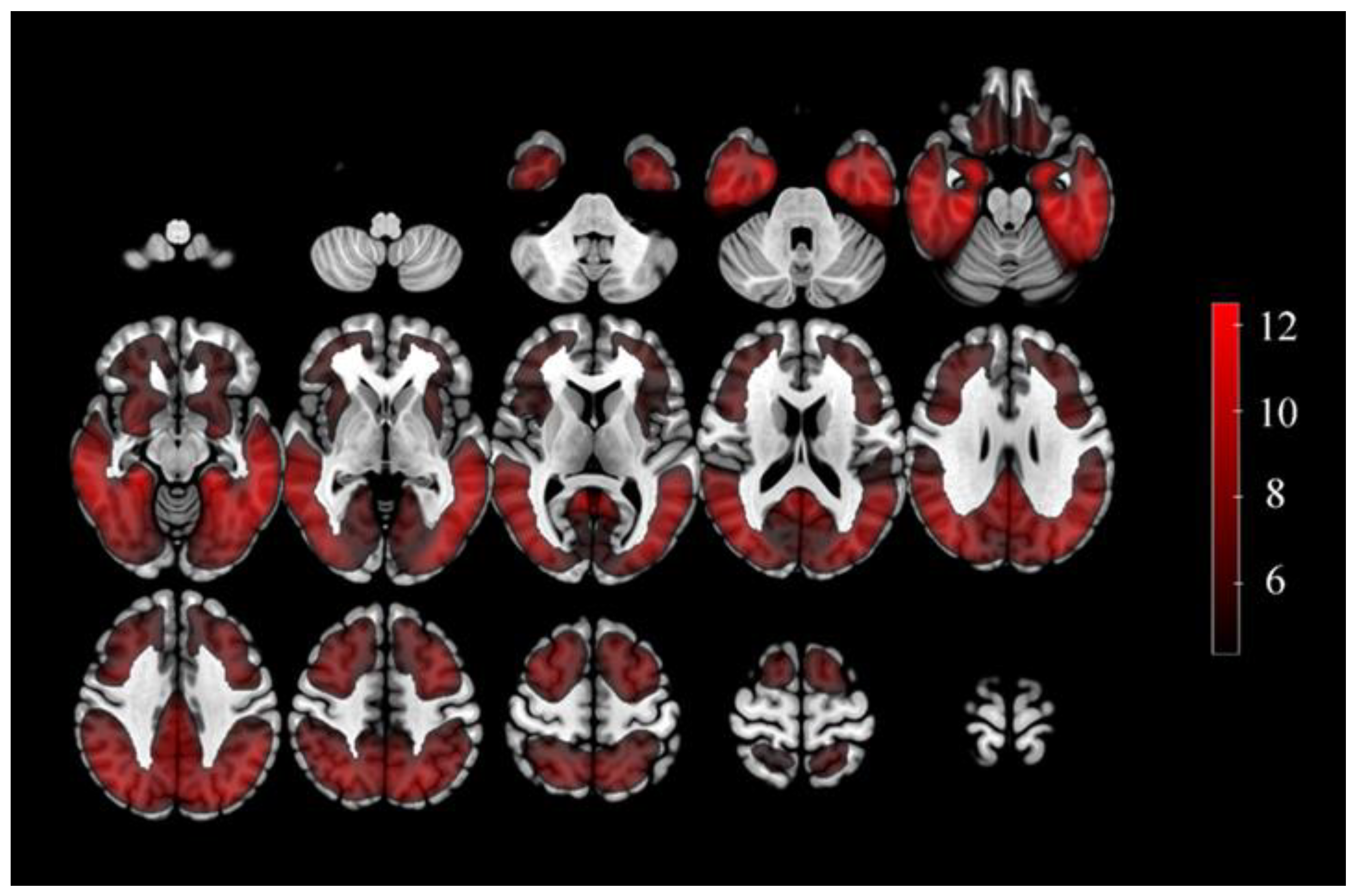 Brainsci 13 00367 g002 Brainsci 13 00367 g002