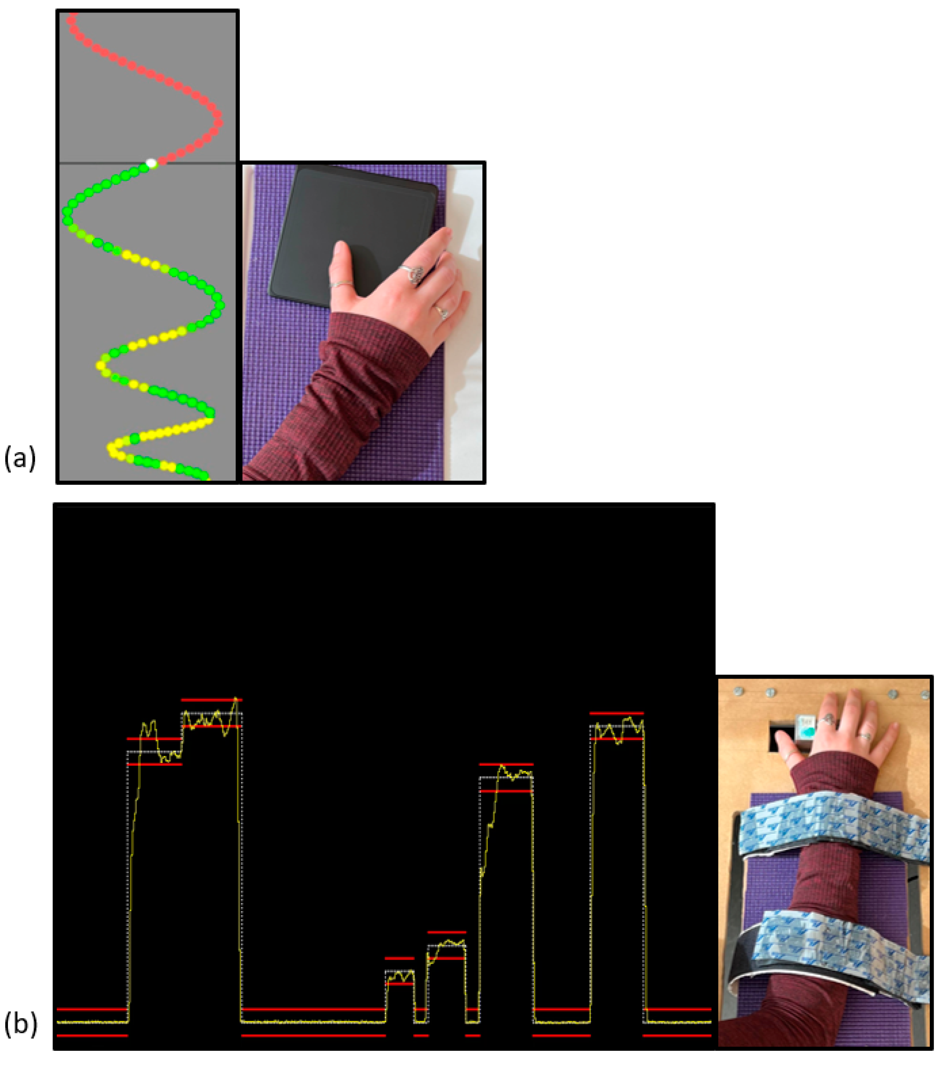 Brainsci 13 00370 g001 Brainsci 13 00370 g001