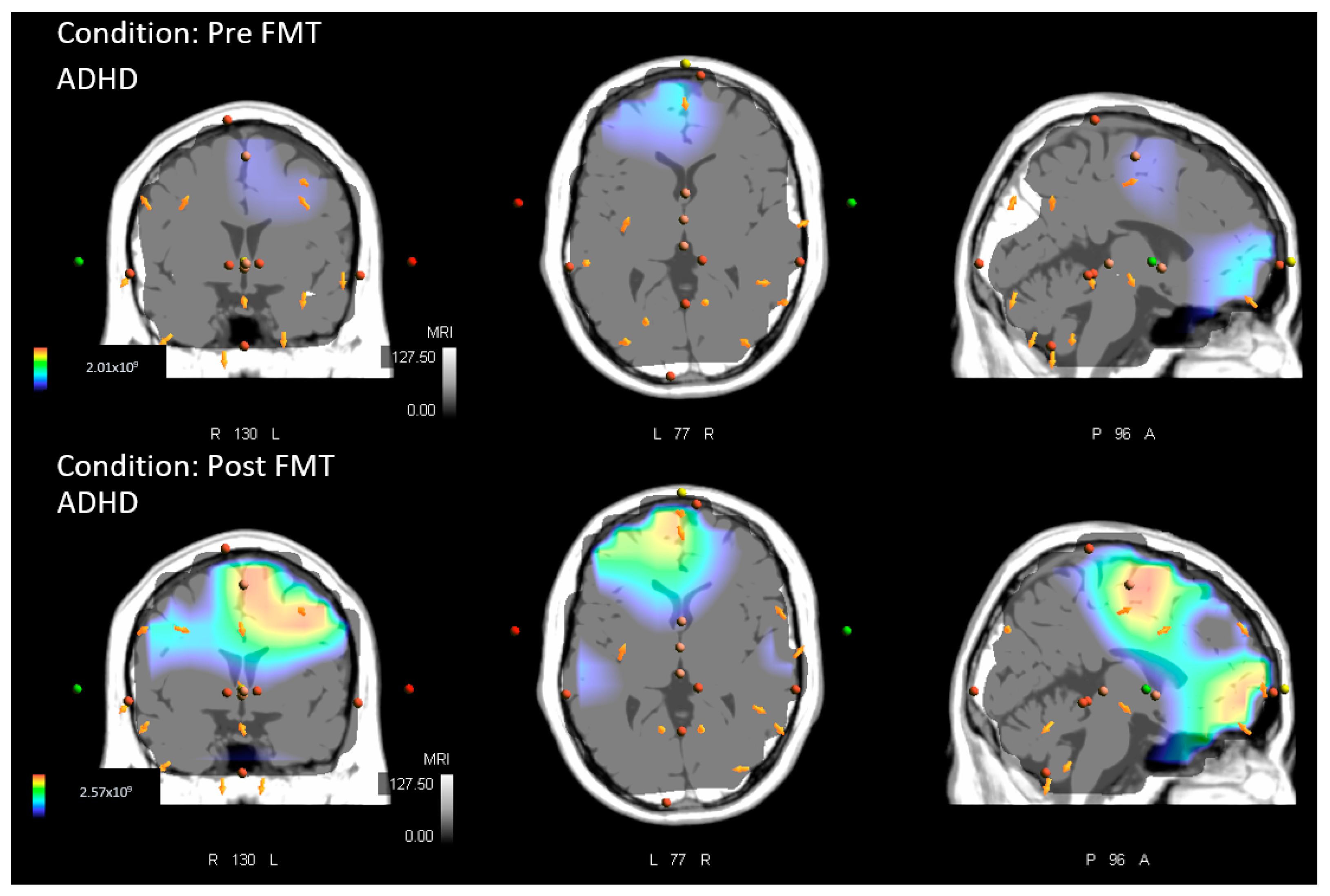 Brainsci 13 00370 g003 Brainsci 13 00370 g003