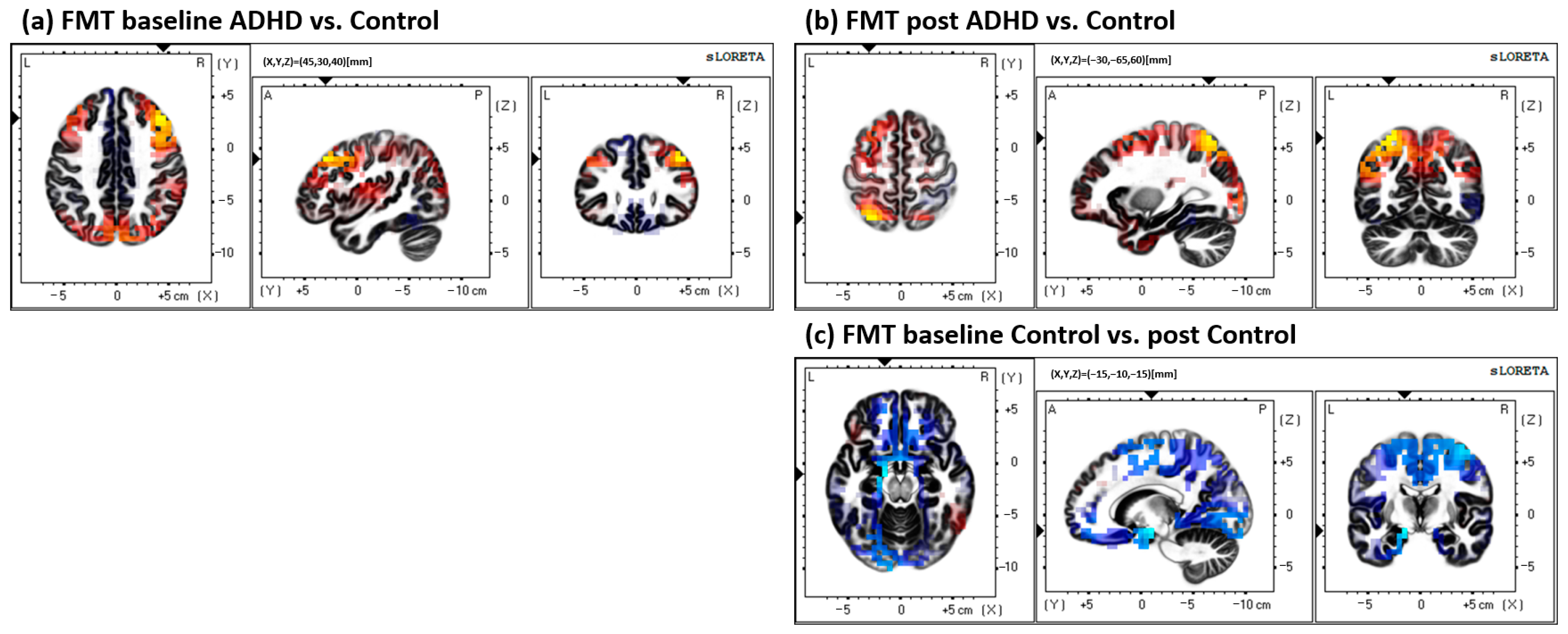 Brainsci 13 00370 g005 Brainsci 13 00370 g005