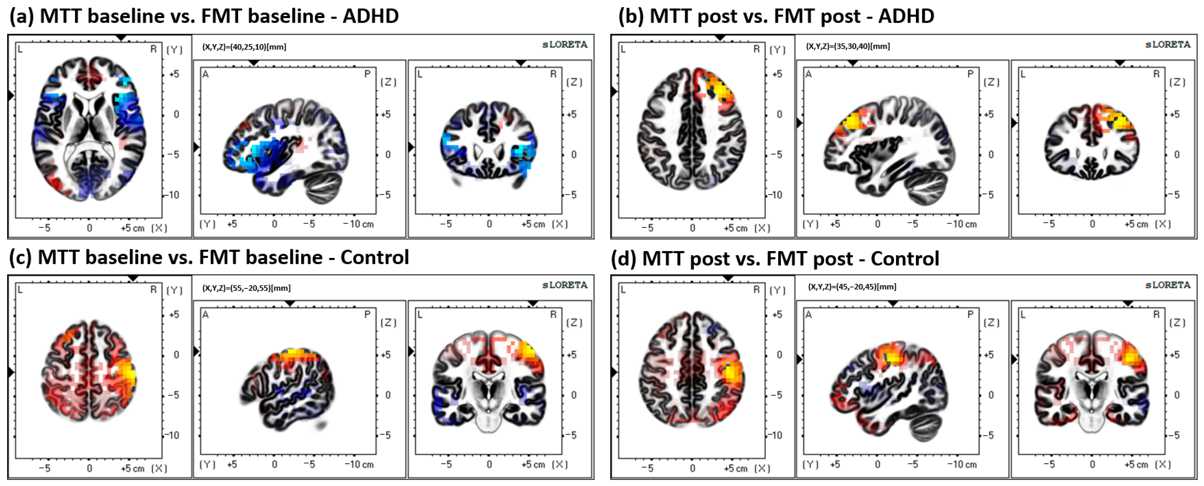 Brainsci 13 00370 g006 Brainsci 13 00370 g006