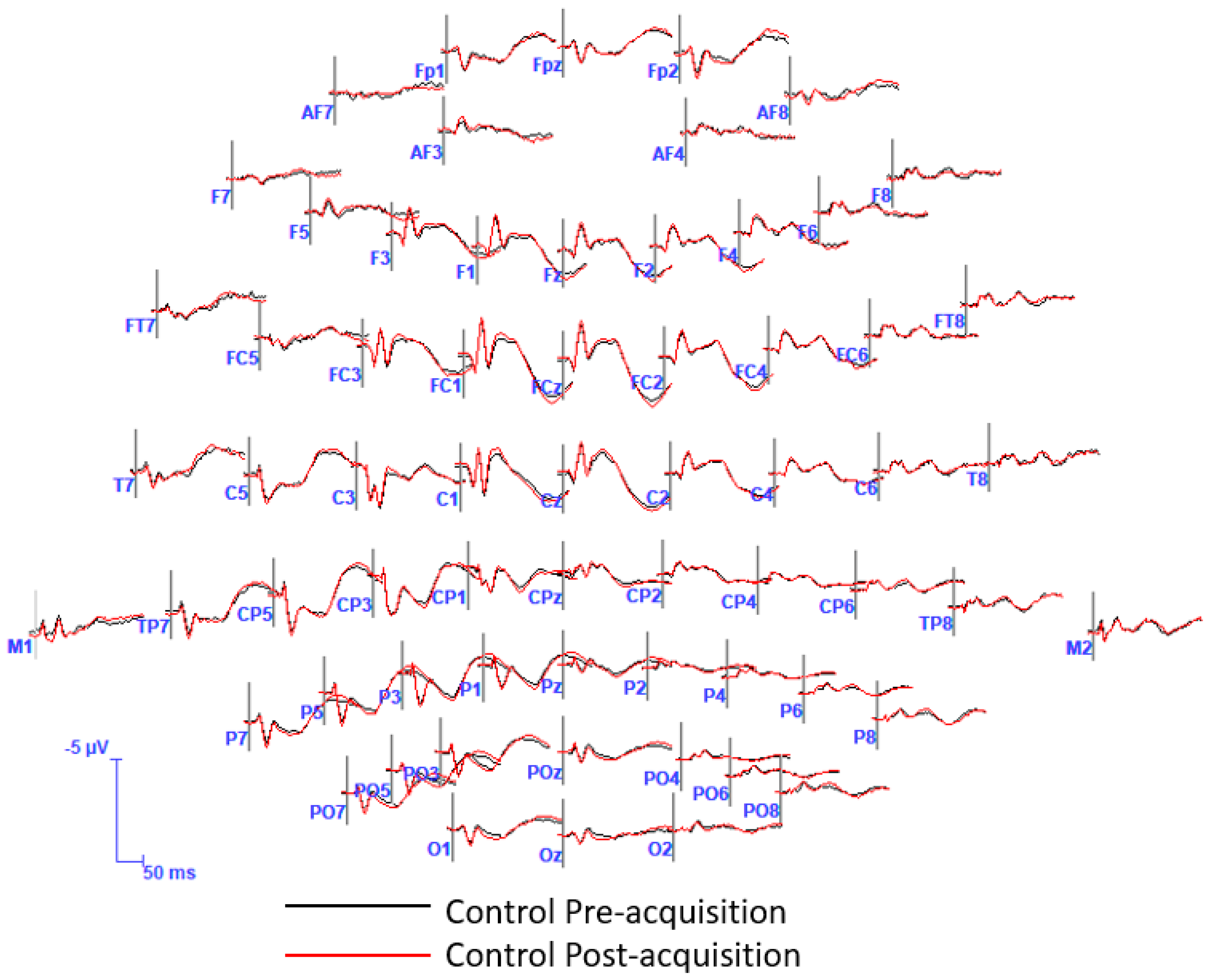 Brainsci 13 00370 g0a2 Brainsci 13 00370 g0a2