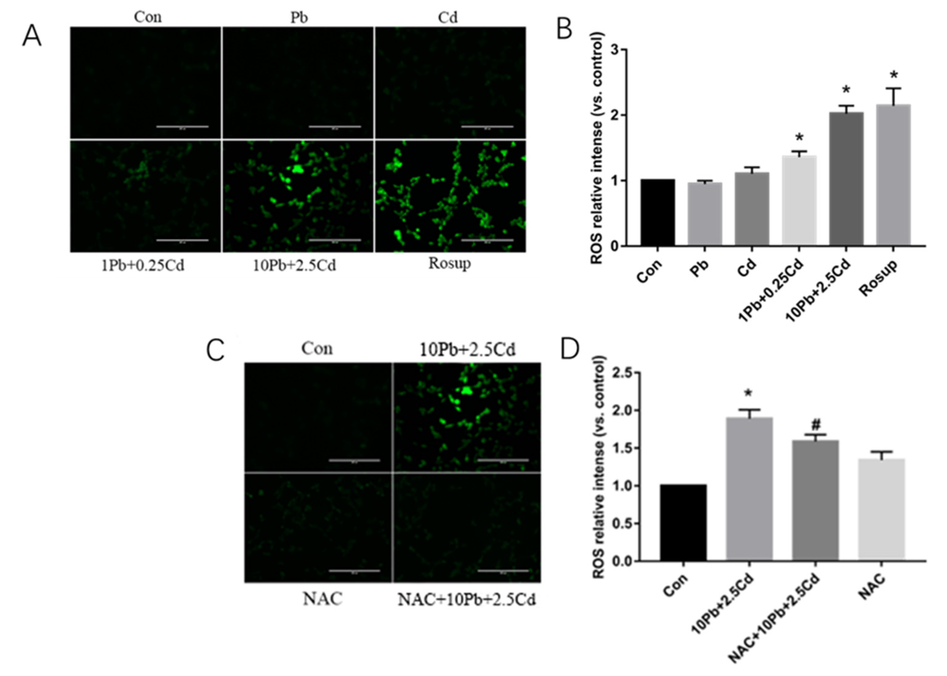 You!様 Y's×SUPERGA MEN's SLIP-ON(26.5 Khaki): Y's｜THE SHOP YOHJI