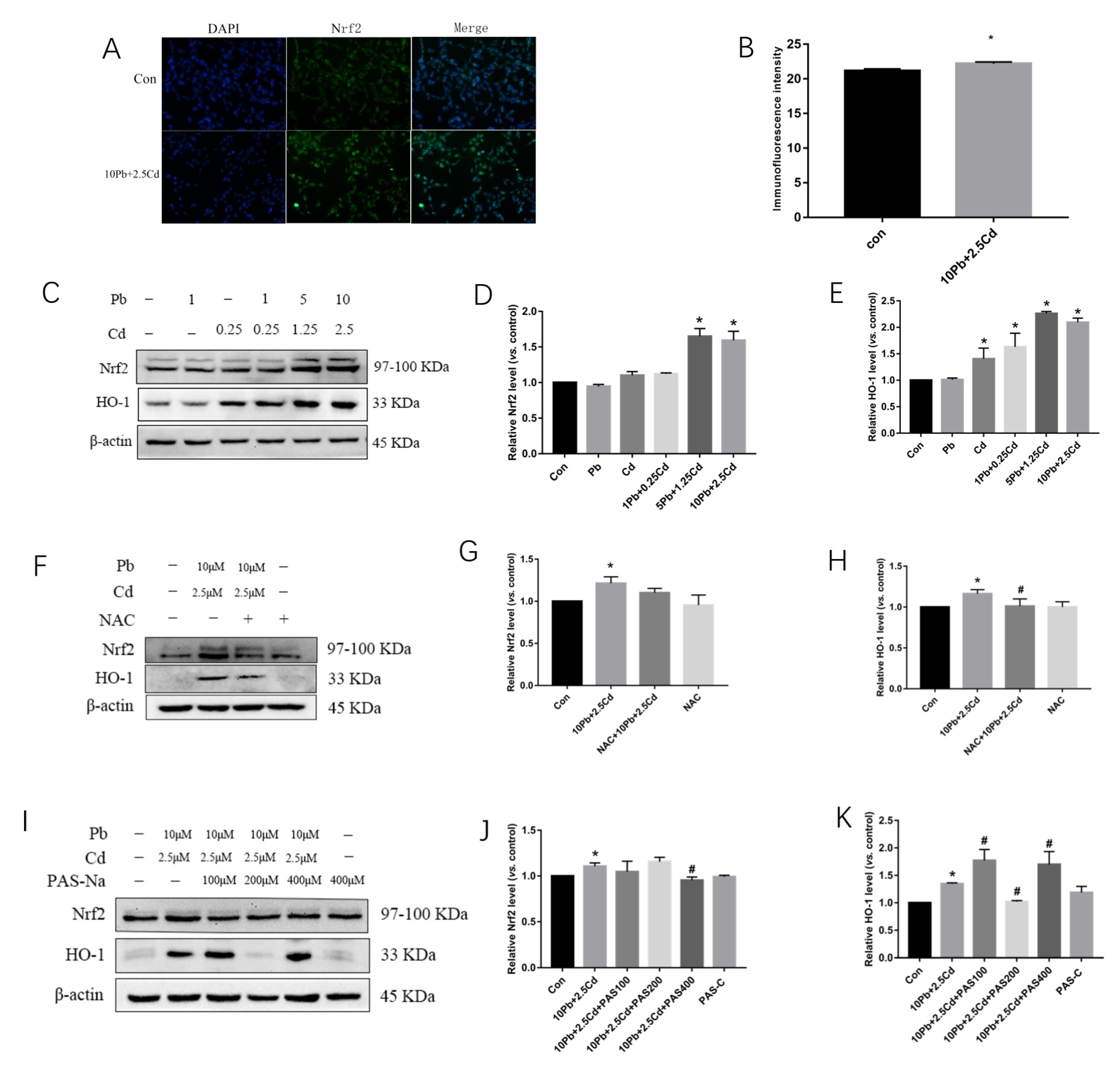 You!様 Y's×SUPERGA MEN's SLIP-ON(26.5 Khaki): Y's｜THE SHOP YOHJI