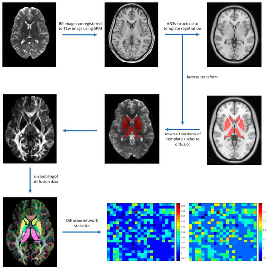 Diffusion Measures of Subcortical Structures Using High
