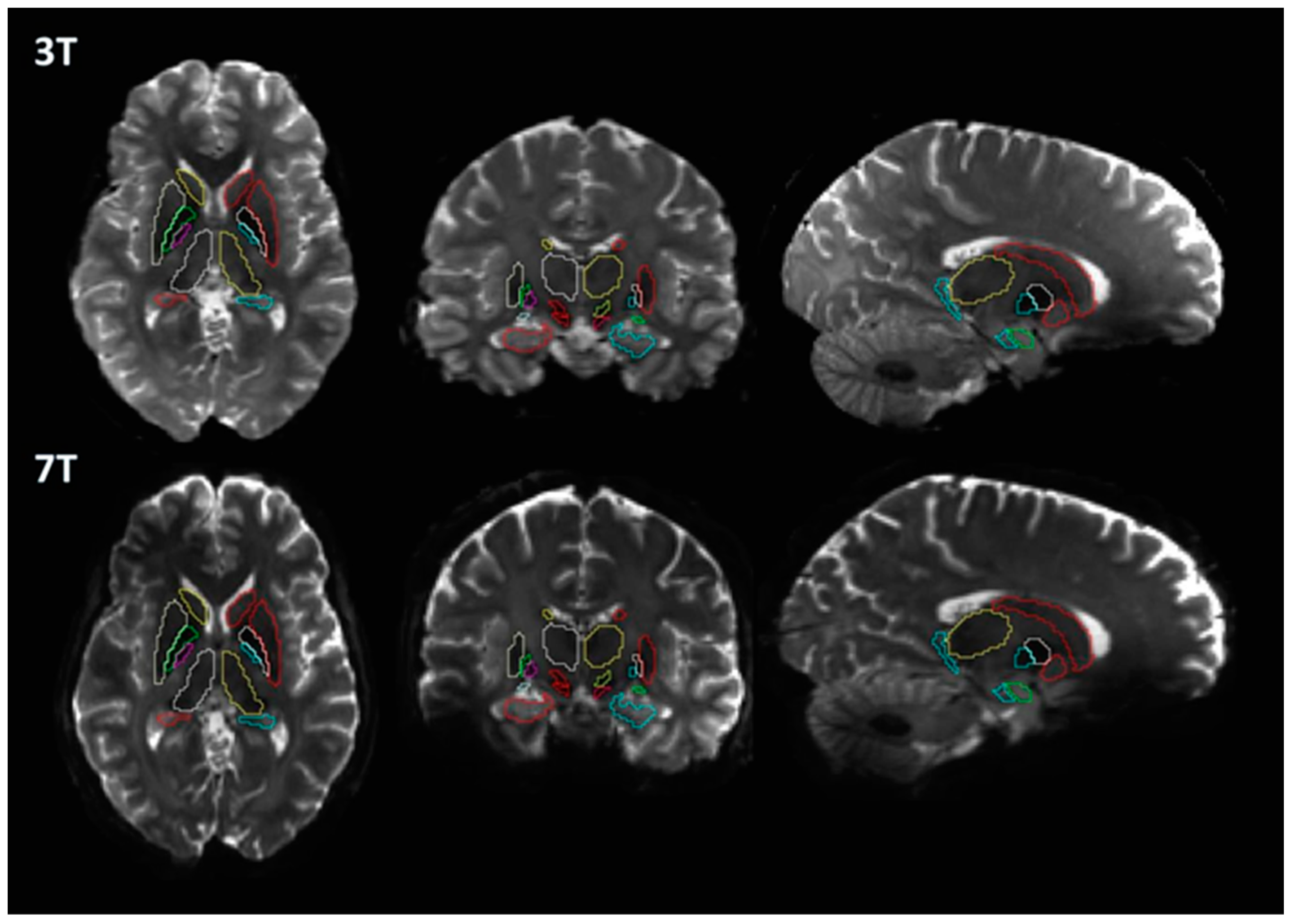 Brainsci 13 00391 g003 Brainsci 13 00391 g003