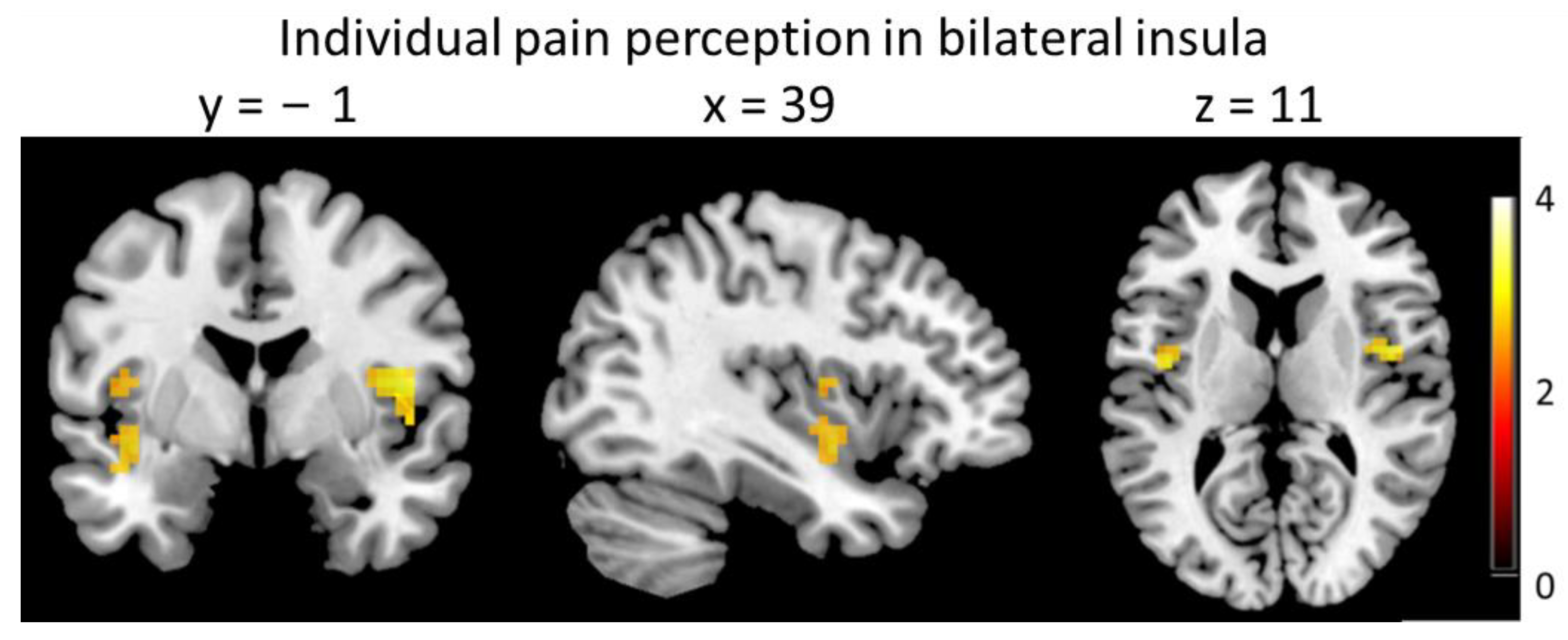 Brainsci 13 00393 g005 Brainsci 13 00393 g005