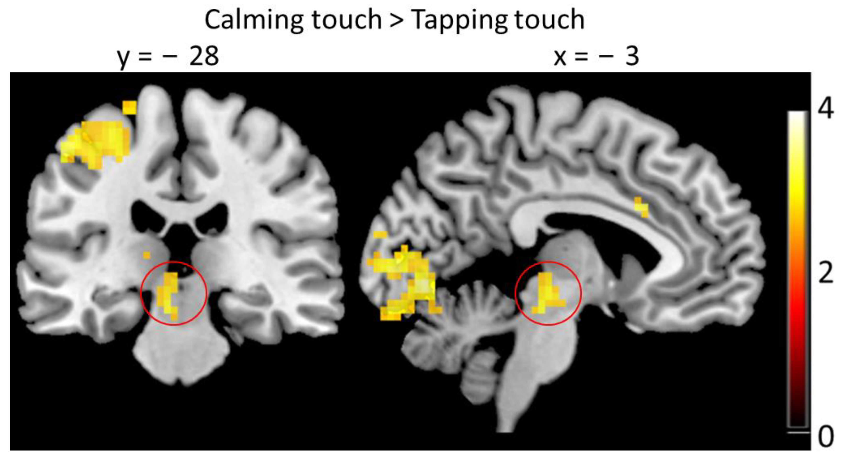 Brainsci 13 00393 g006 Brainsci 13 00393 g006