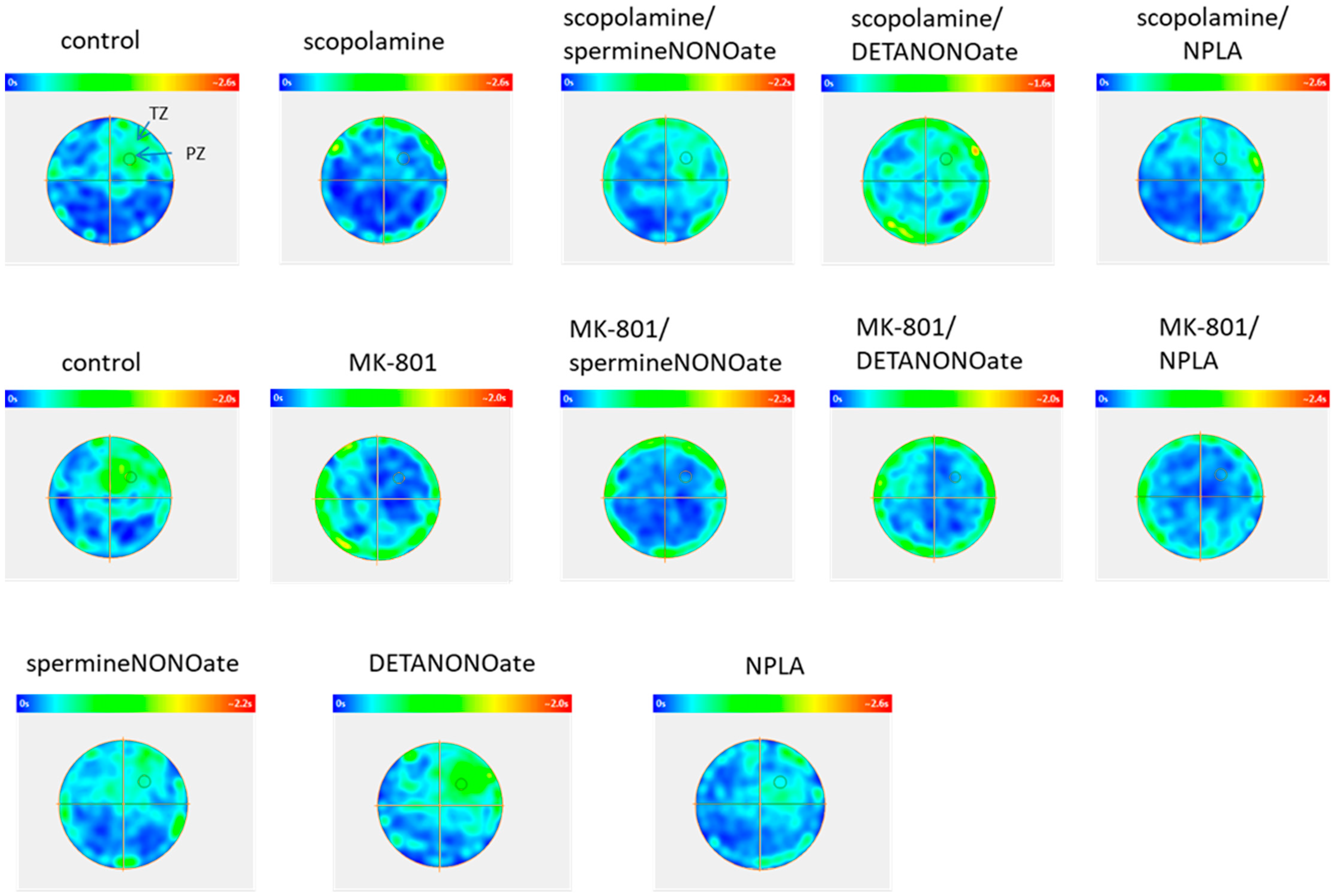 Brainsci 13 00410 g015 Brainsci 13 00410 g015