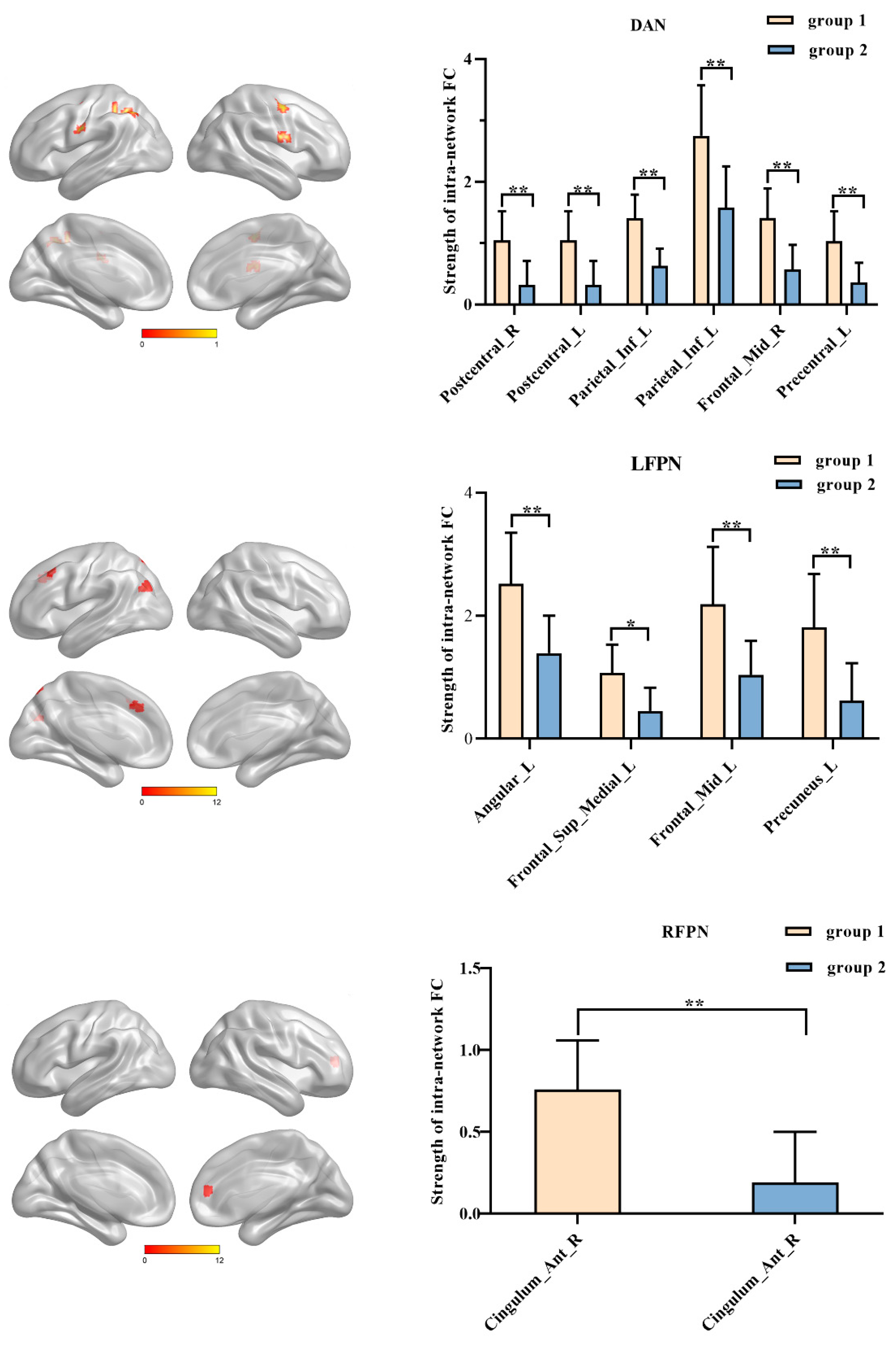 Brainsci 13 00419 g004 Brainsci 13 00419 g004