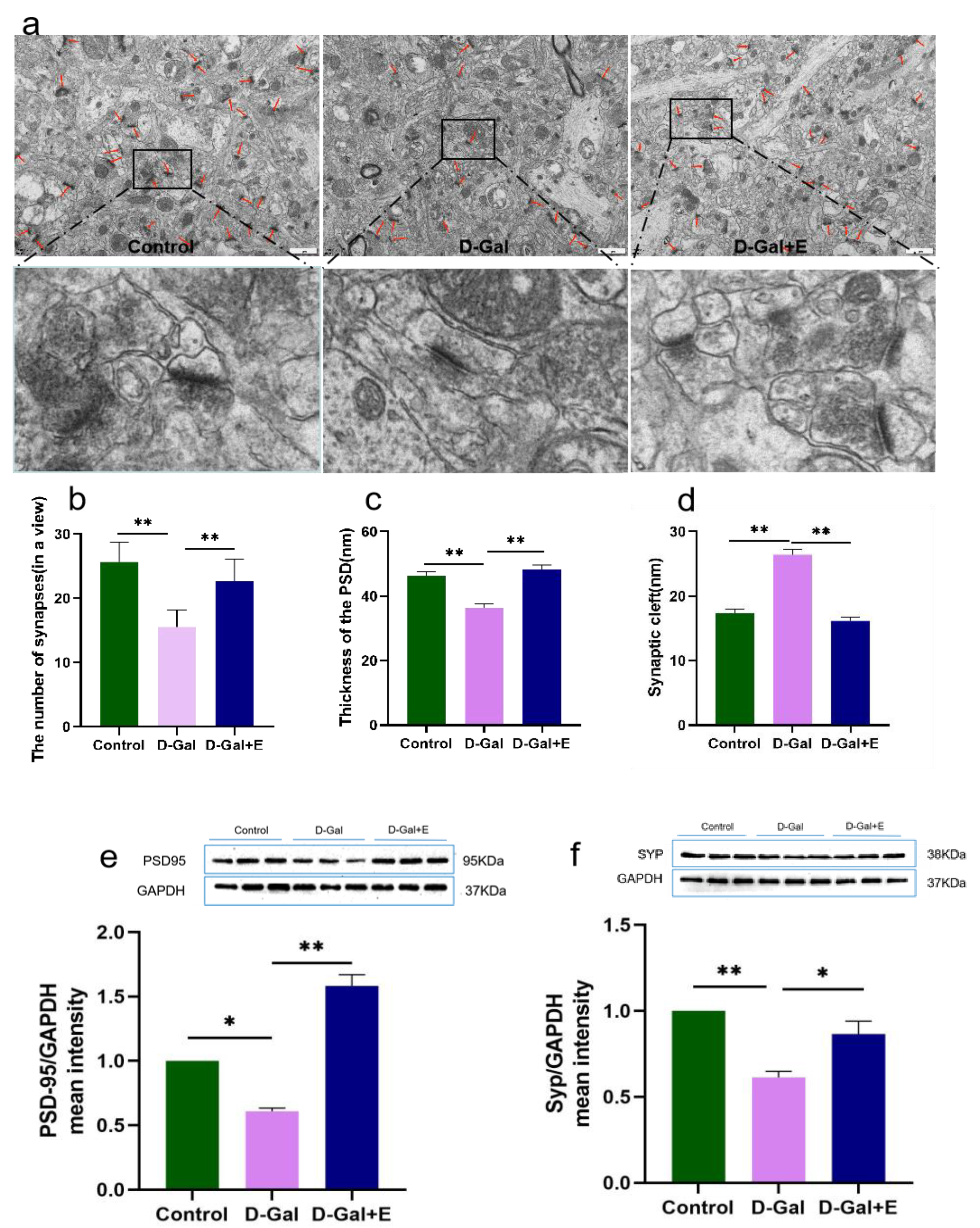 Brainsci 13 00422 g002 Brainsci 13 00422 g002