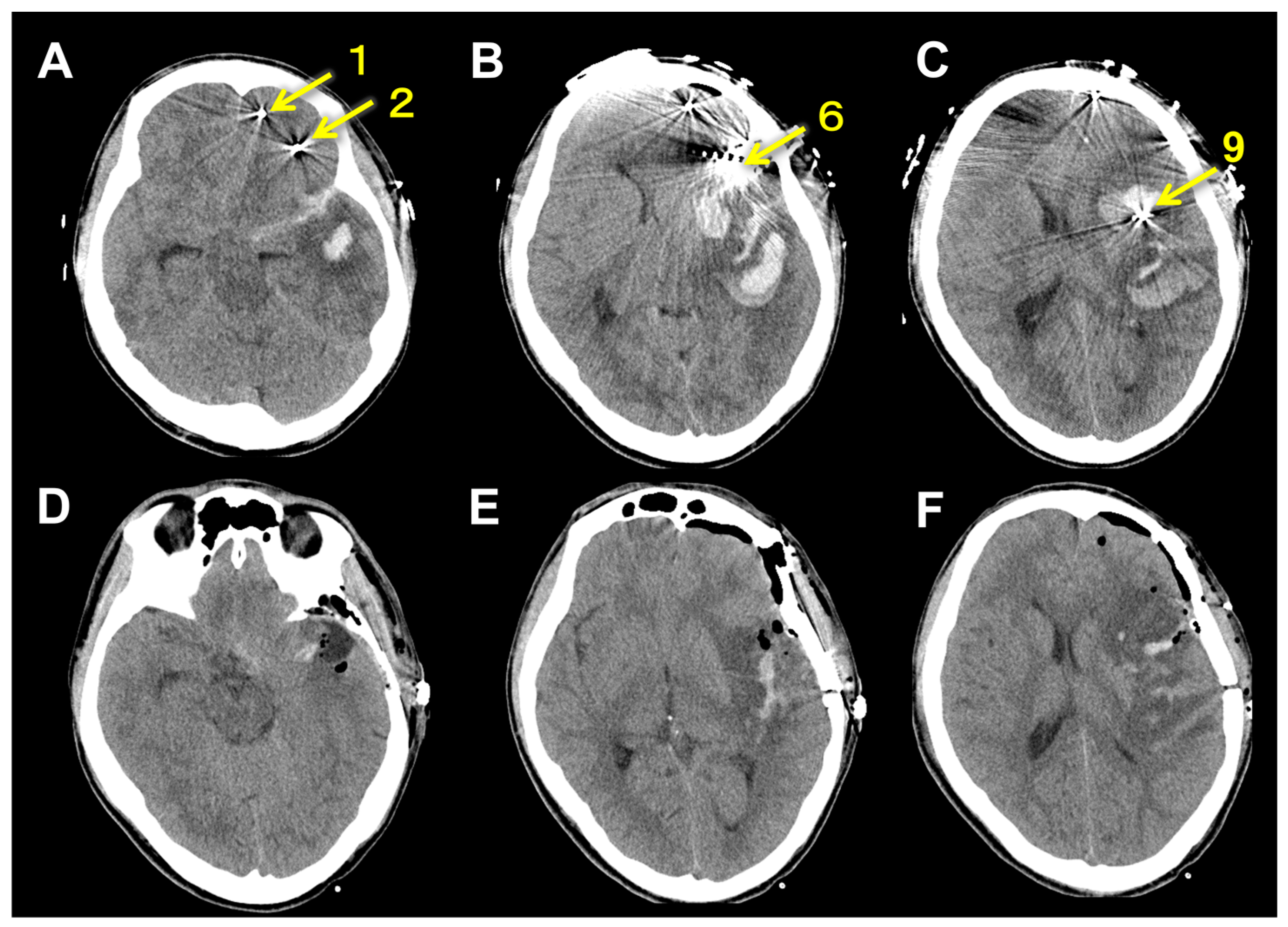 Brainsci 13 00440 g003