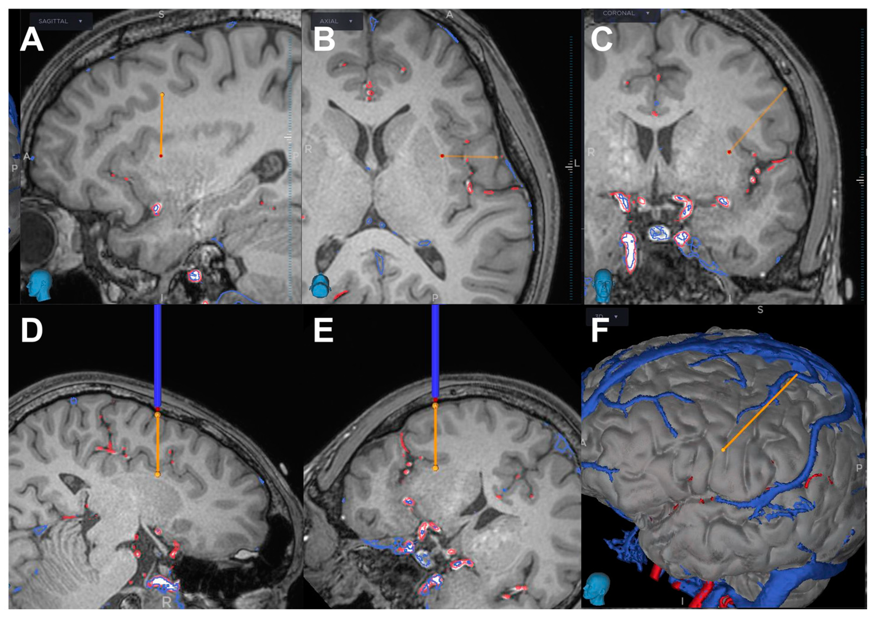 Brainsci 13 00440 g004
