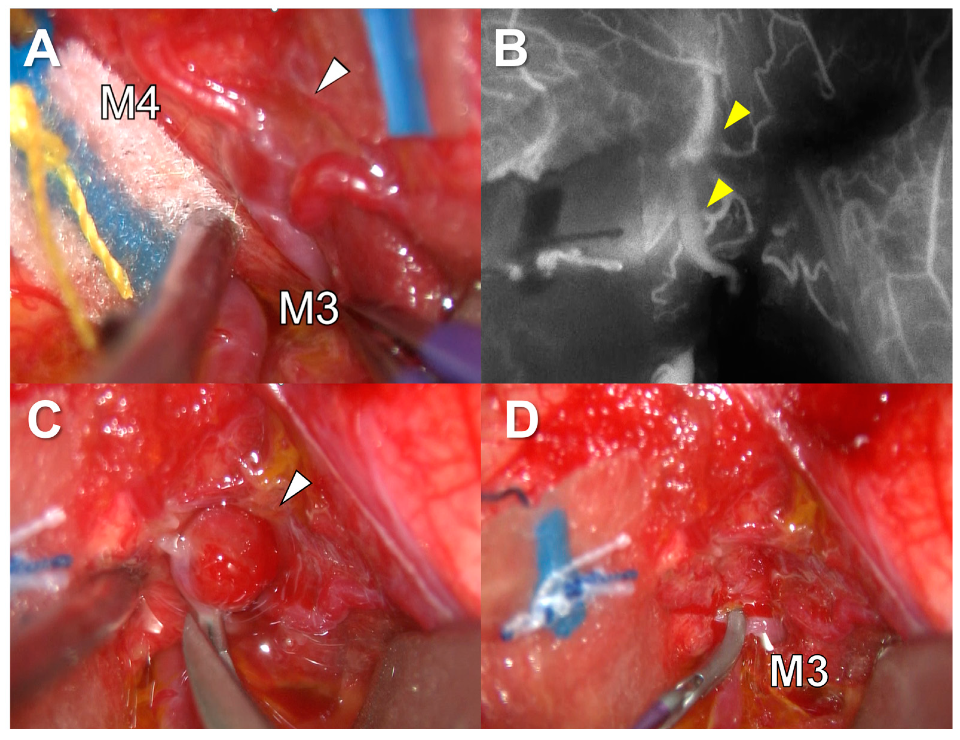 Brainsci 13 00440 g006