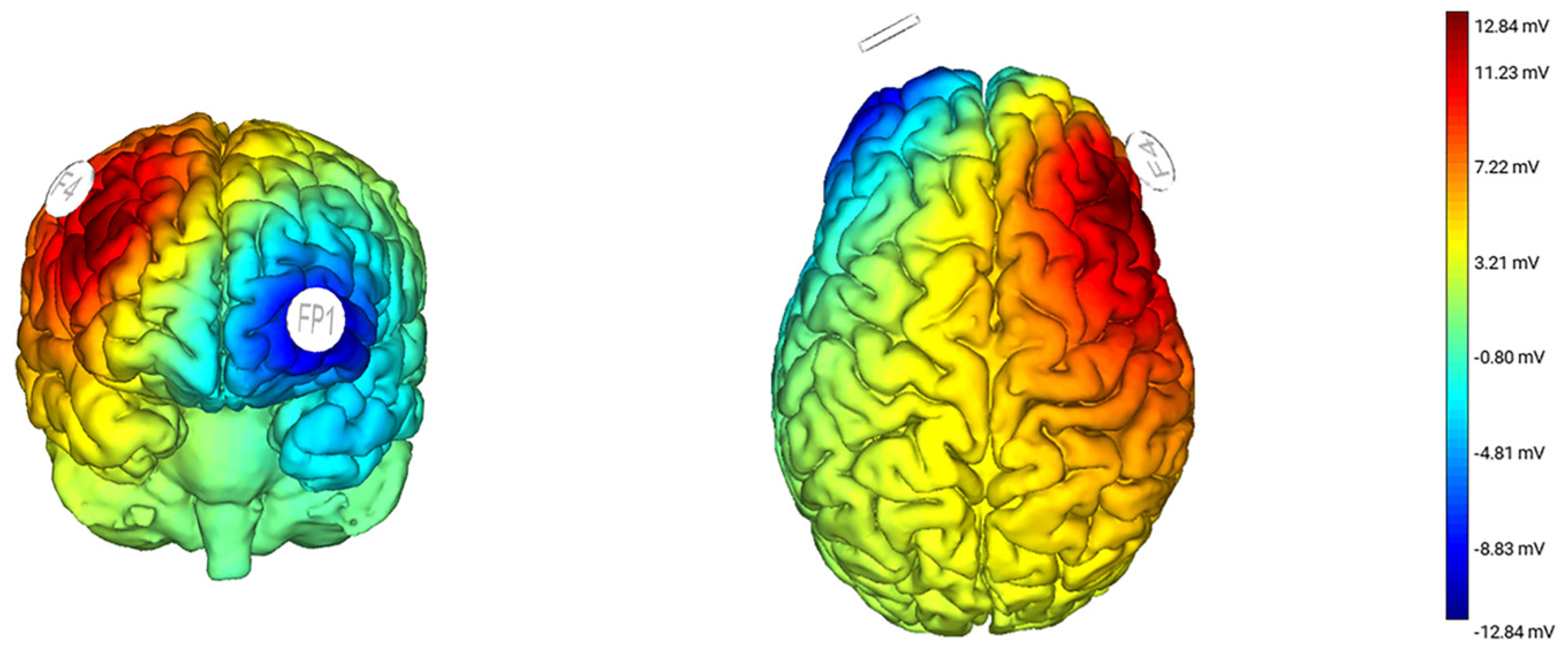 dorsolateral prefrontal cortex tdcs