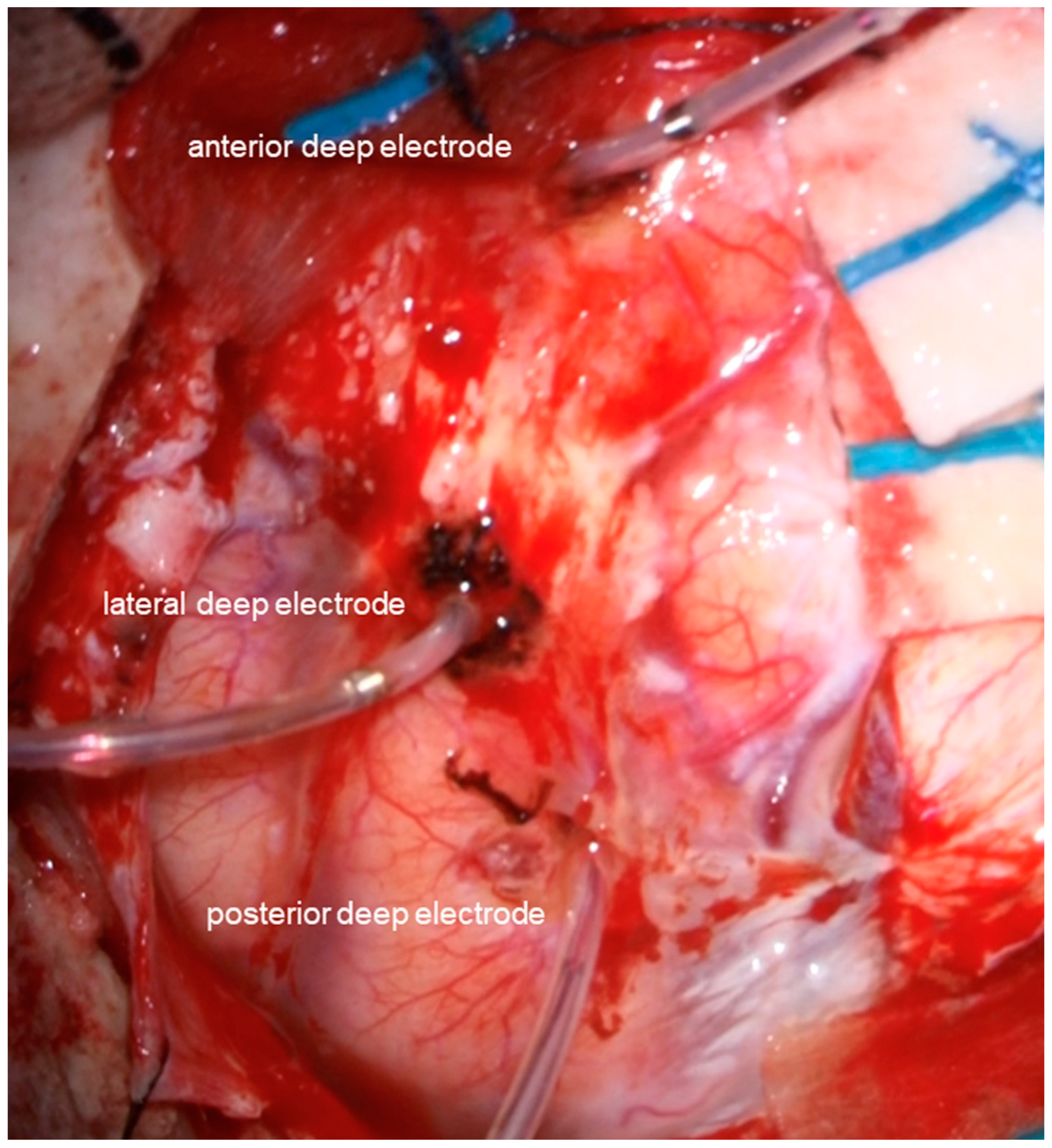 Brainsci 13 00482 g002