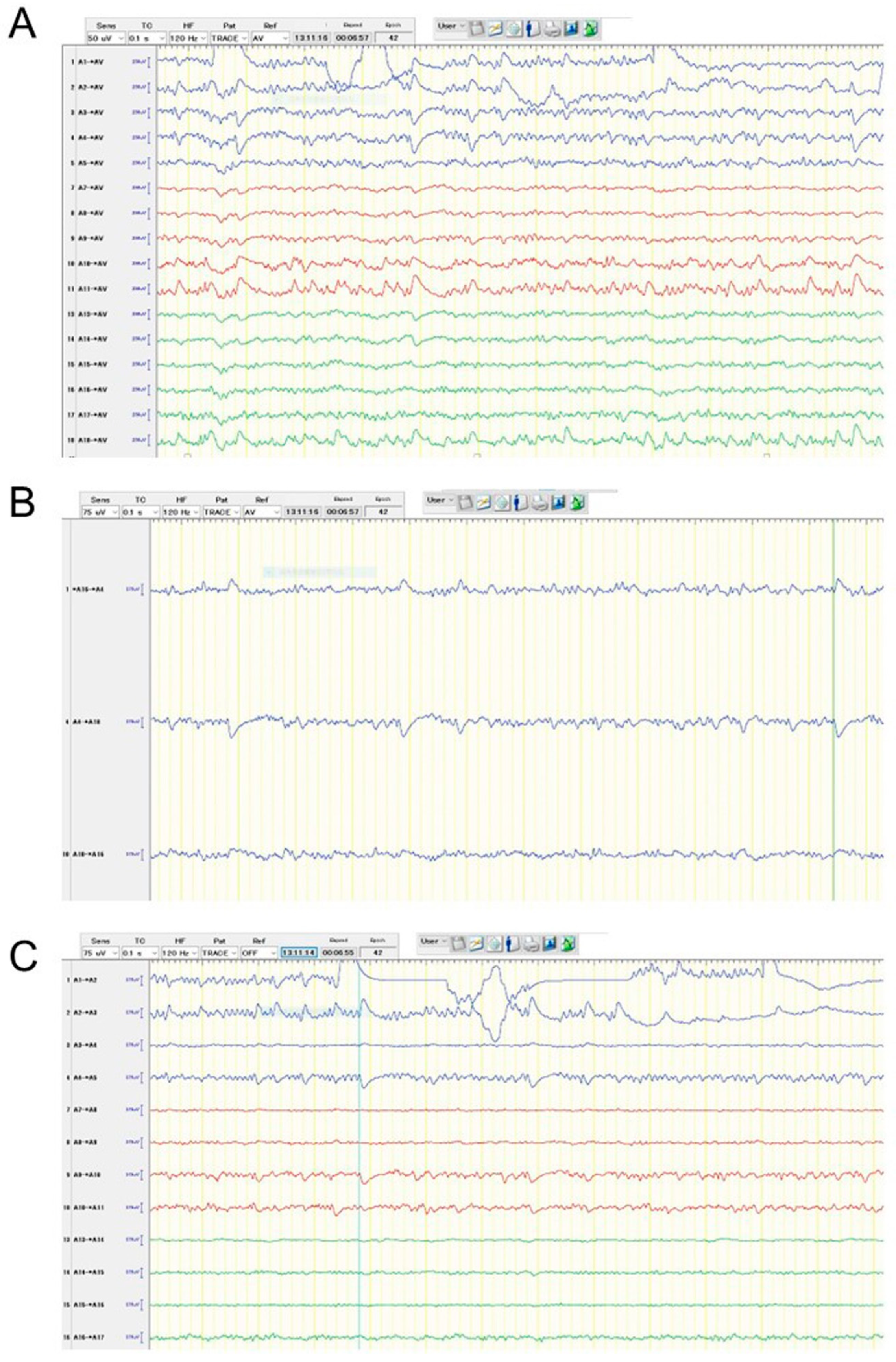 Brainsci 13 00482 g003