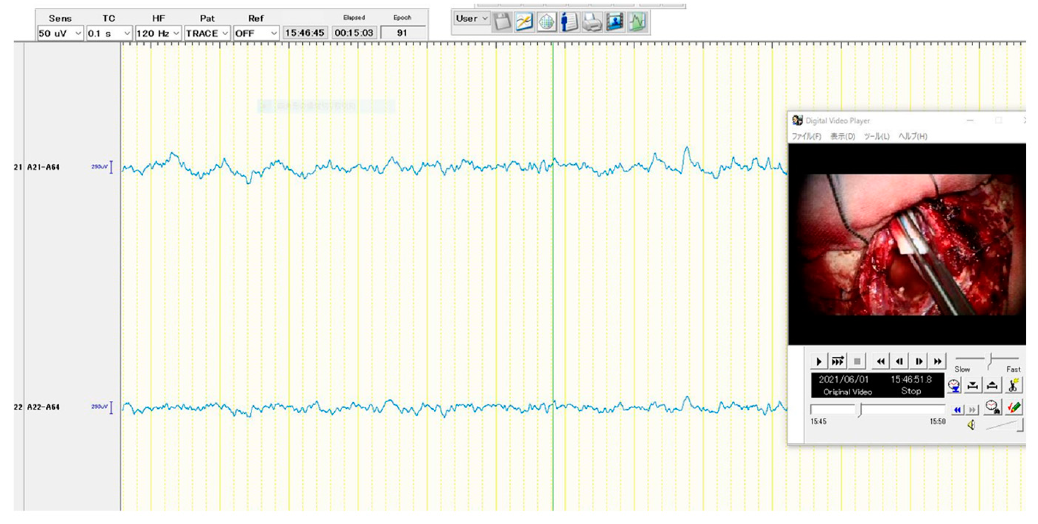 Brainsci 13 00482 g004