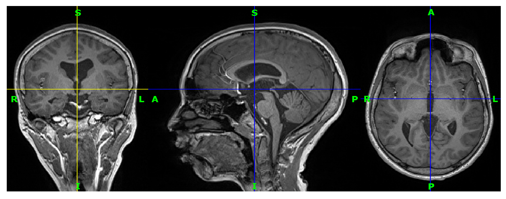 Brainsci 13 00487 g005
