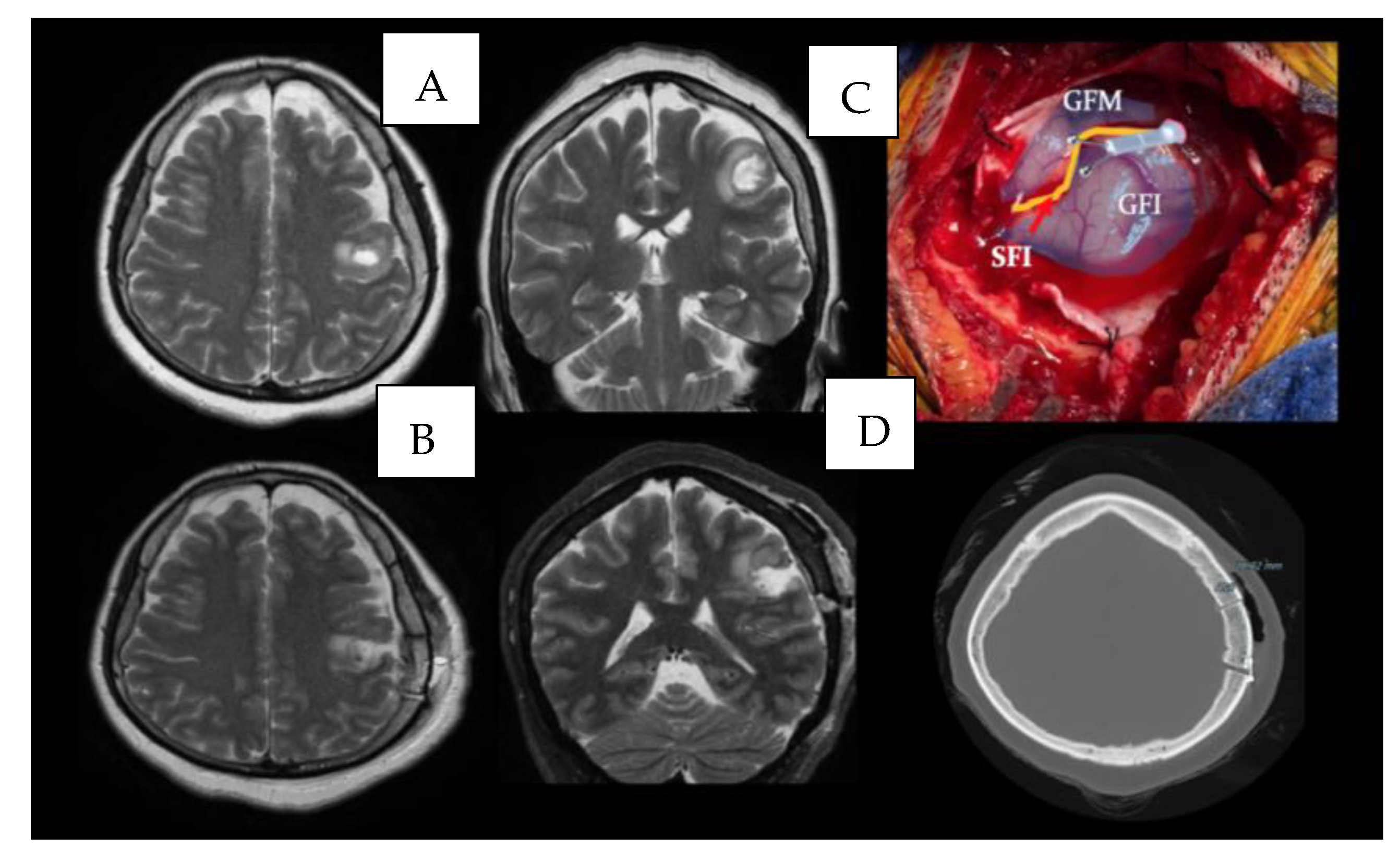 Brainsci 13 00498 g005 Brainsci 13 00498 g005