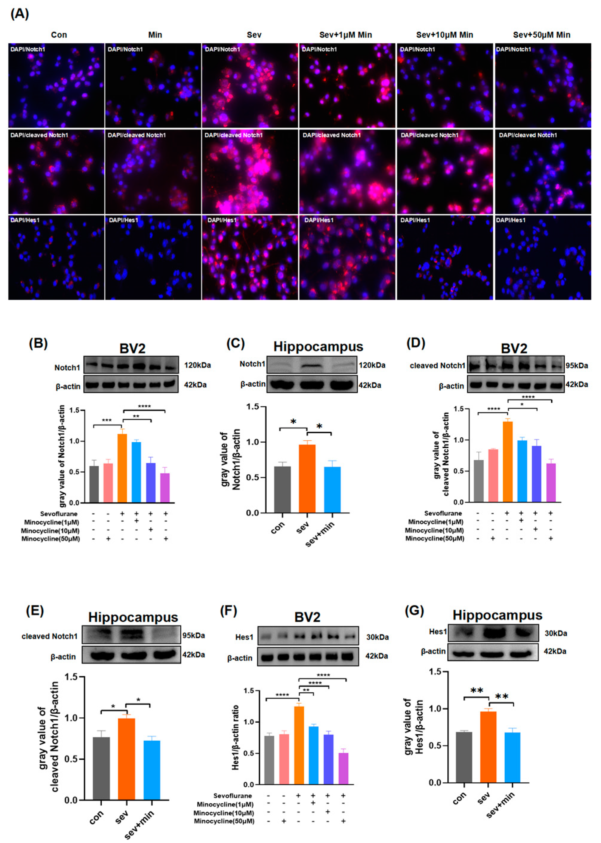 Brainsci 13 00512 g006