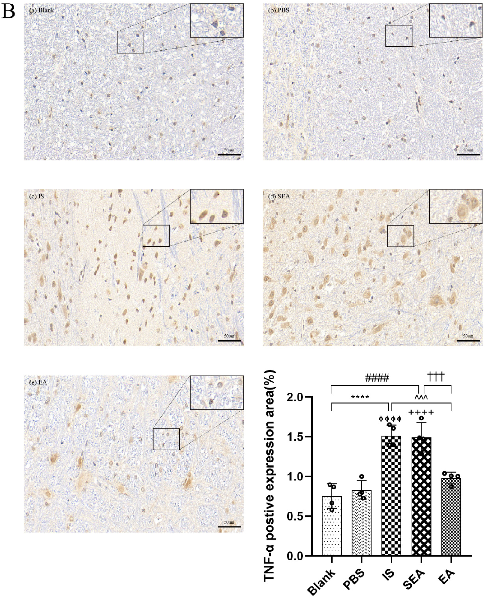 Brainsci 13 00541 g005b Brainsci 13 00541 g005b