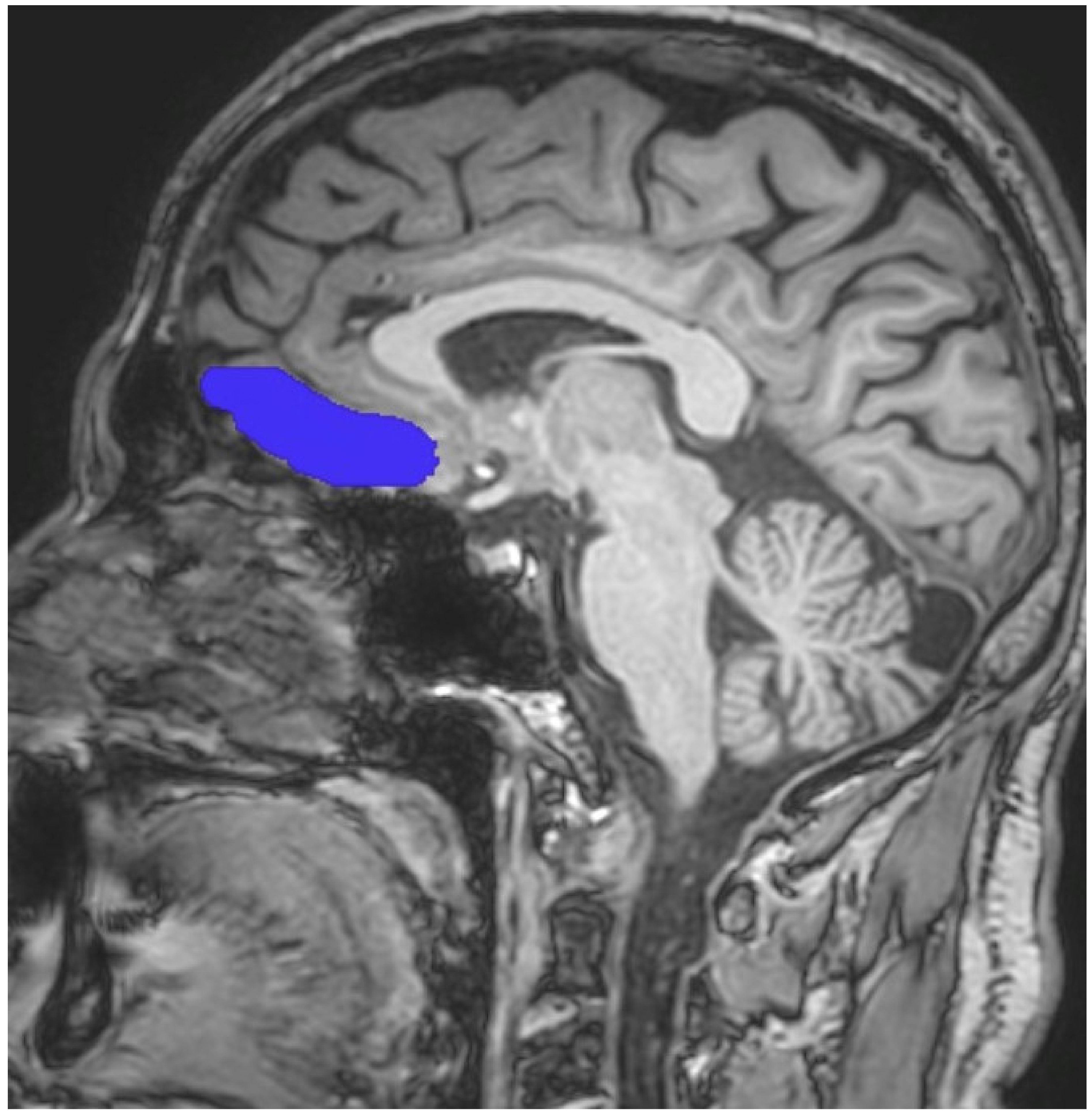 Brainsci 13 00552 g001 Brainsci 13 00552 g001