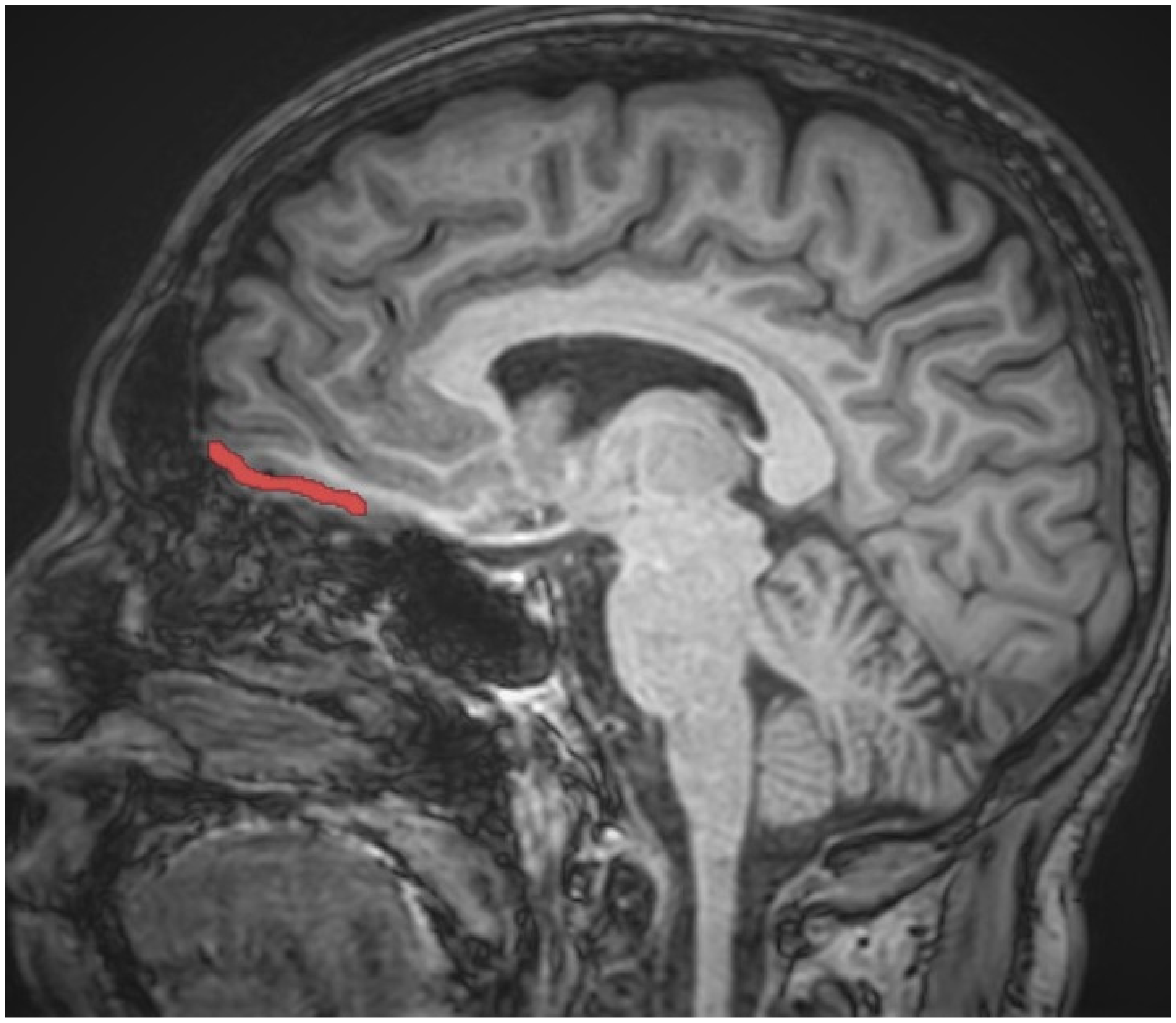 Brainsci 13 00552 g002 Brainsci 13 00552 g002