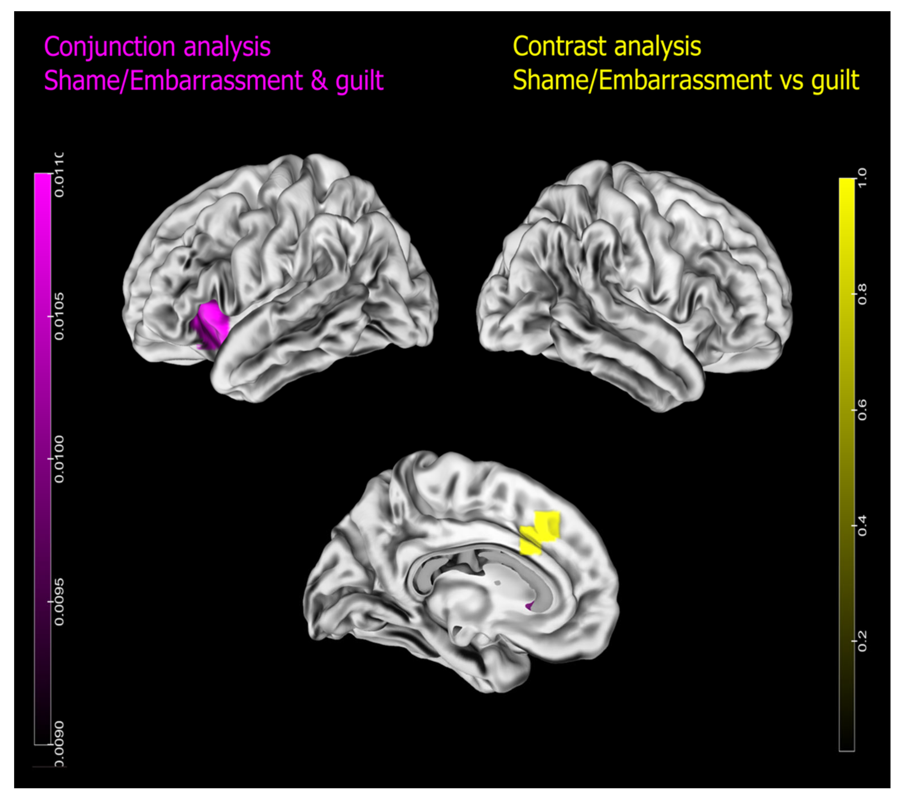 Brainsci 13 00559 g003 Brainsci 13 00559 g003