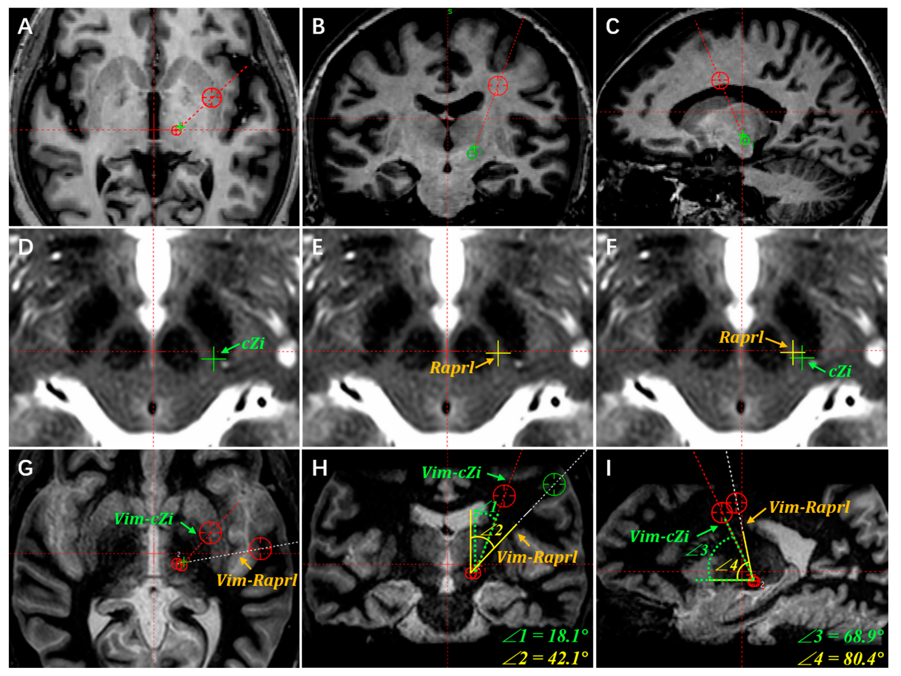 Brainsci 13 00566 g002 Brainsci 13 00566 g002