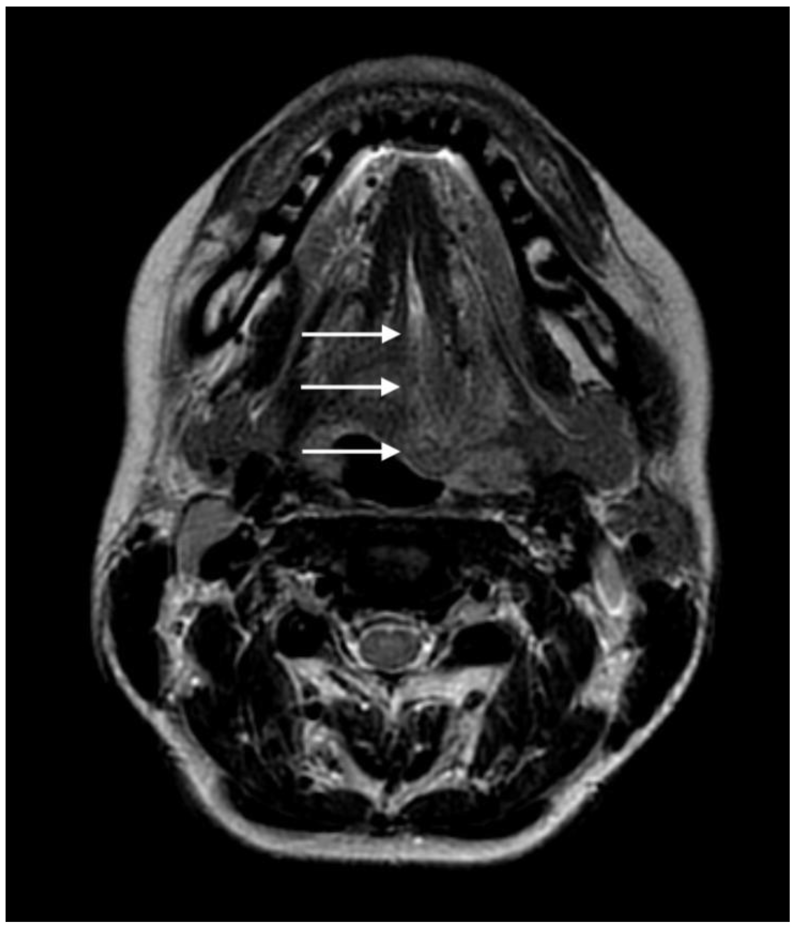 Brainsci 13 00603 g003 Brainsci 13 00603 g003