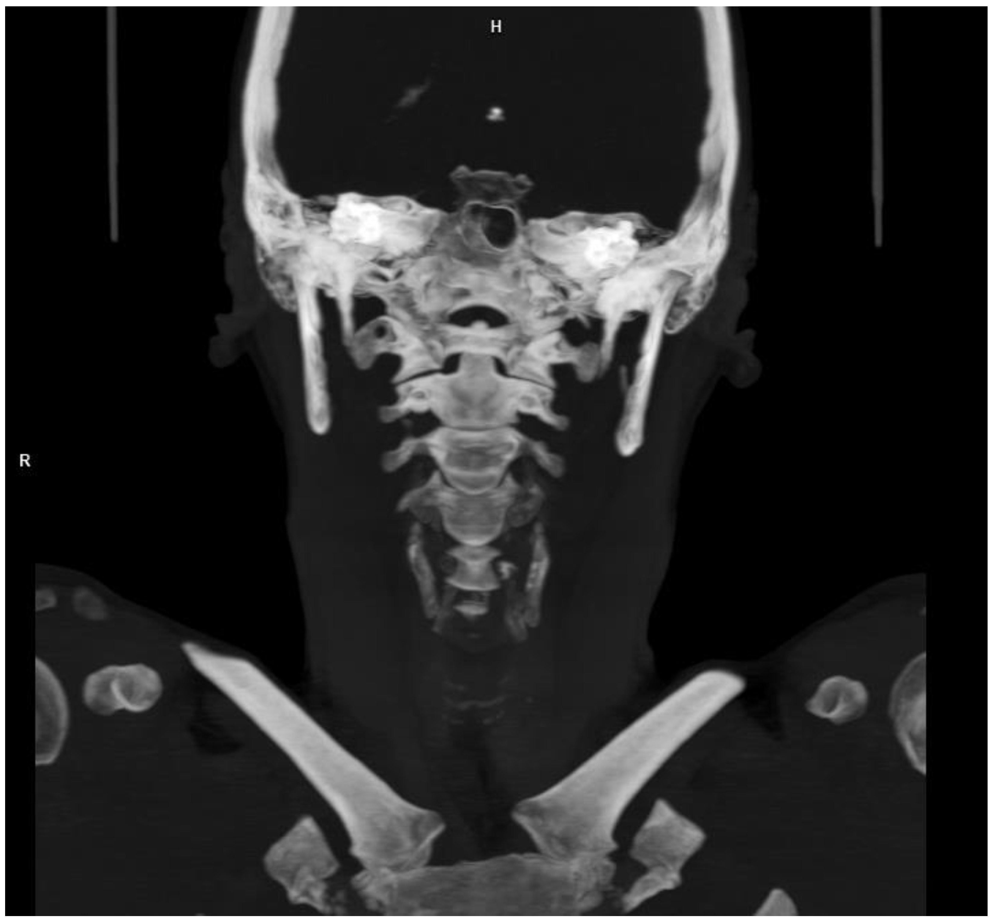 Brainsci 13 00603 g004 Brainsci 13 00603 g004