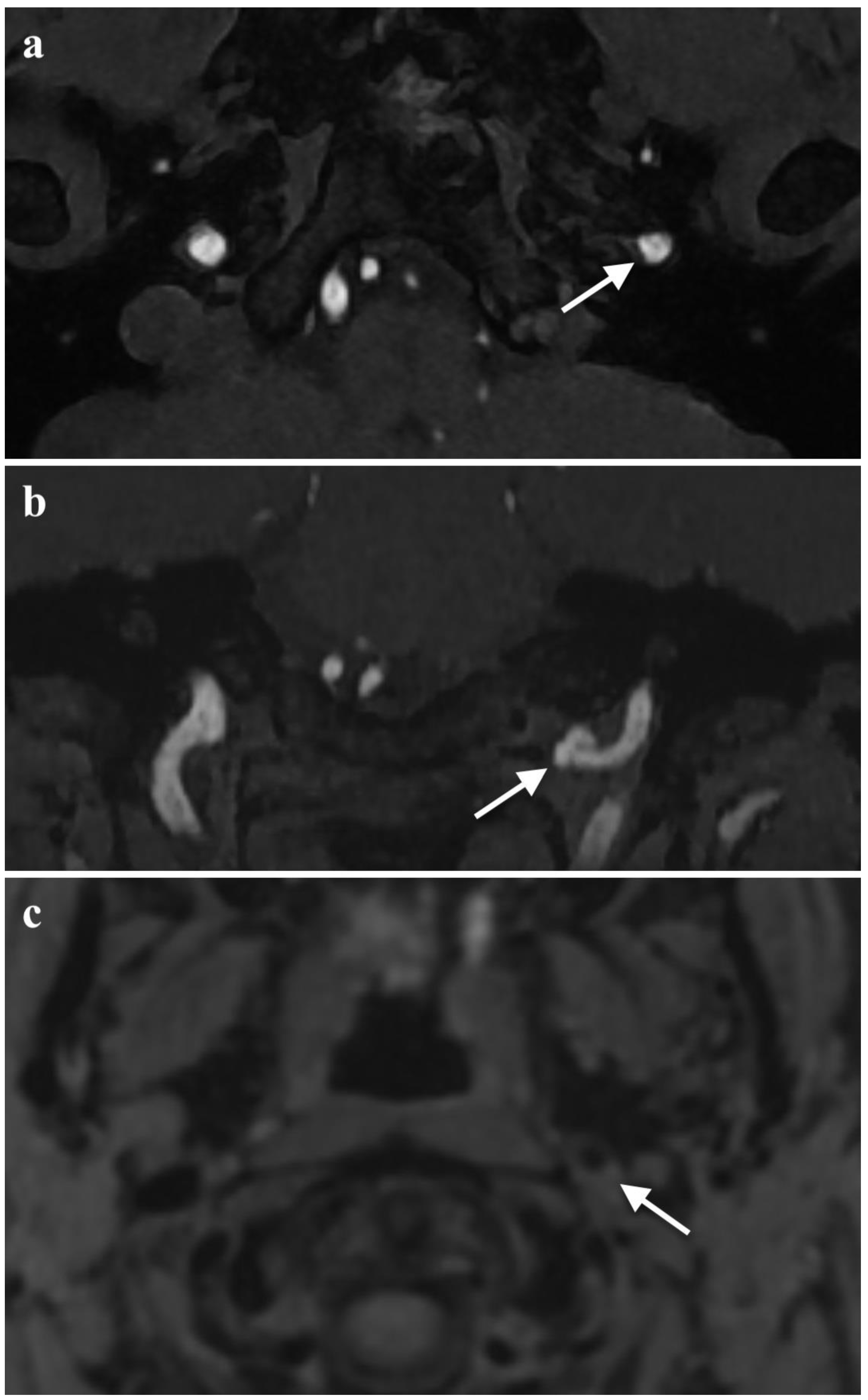 Brainsci 13 00603 g005 Brainsci 13 00603 g005