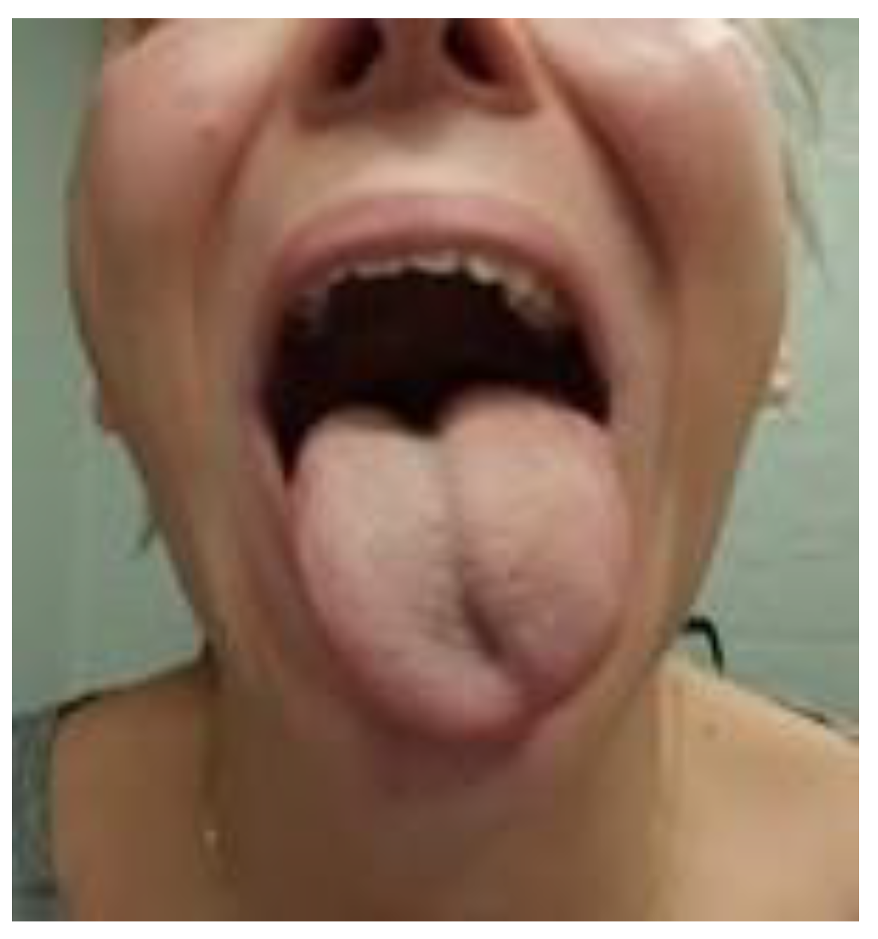 Brainsci 13 00603 g006 Brainsci 13 00603 g006