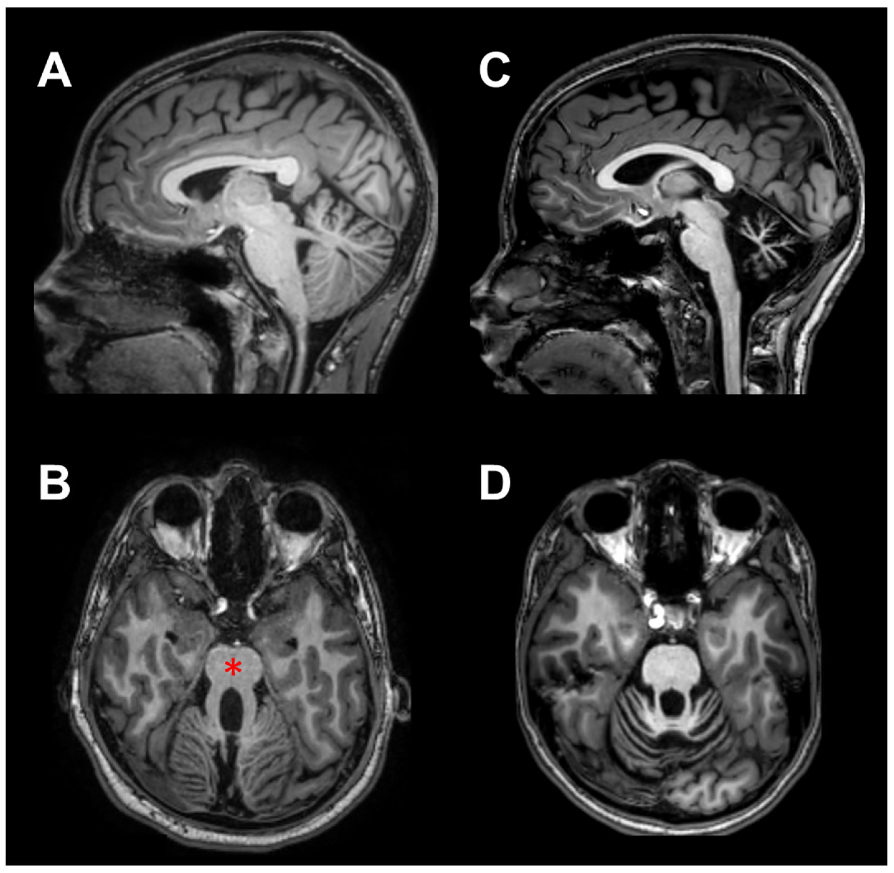 Brainsci 13 00620 g001 Brainsci 13 00620 g001