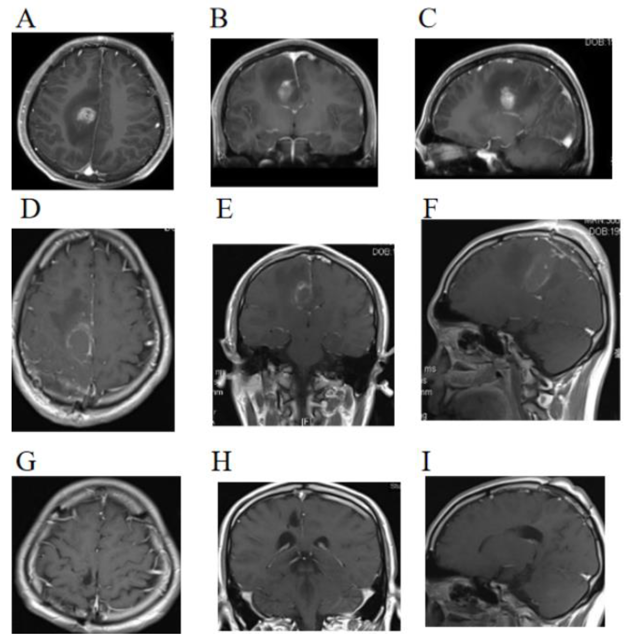Brainsci 13 00633 g001